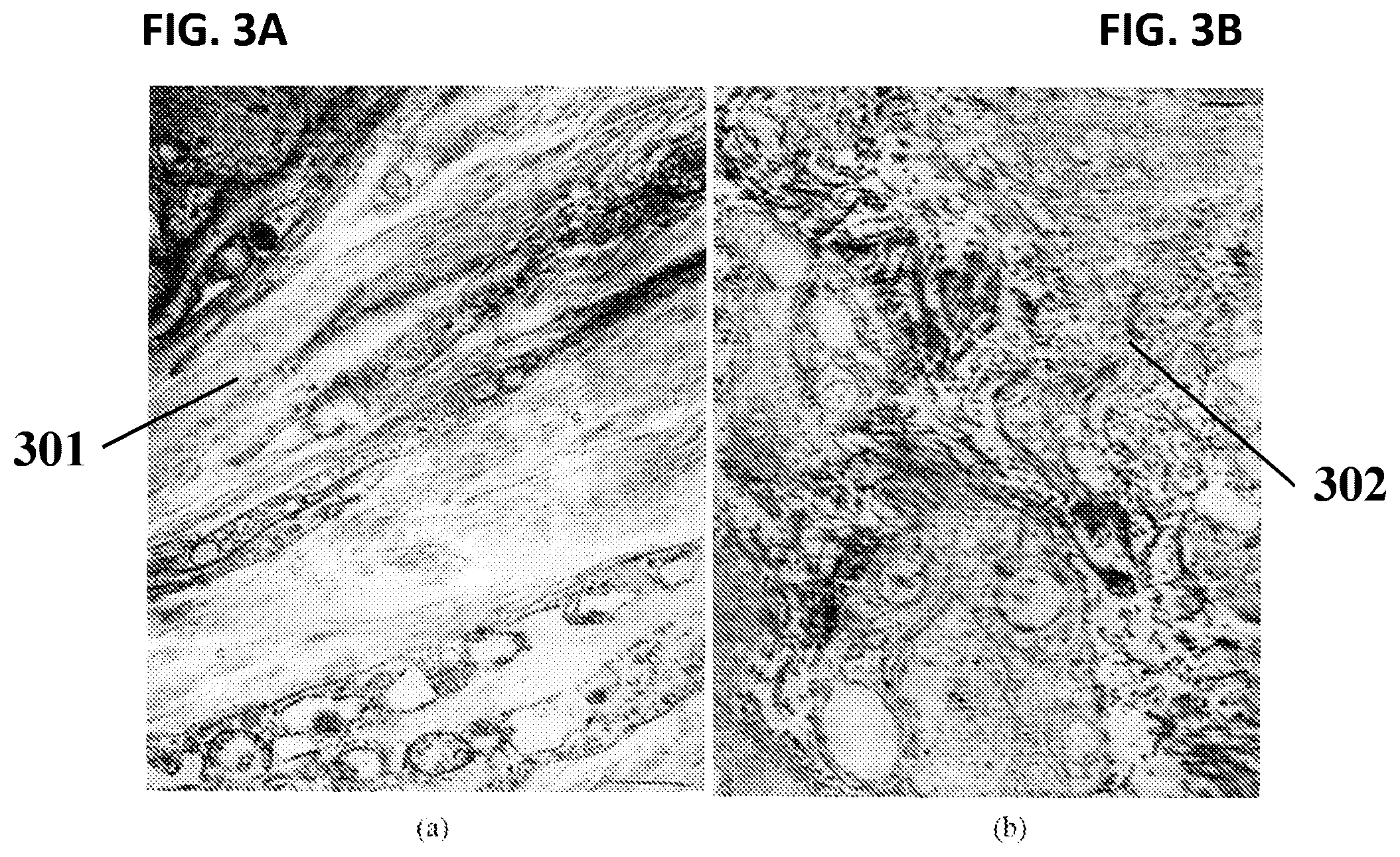 Patent US12588883 Figure 3 – X-ray system and method for tissue structural analysis and imaging