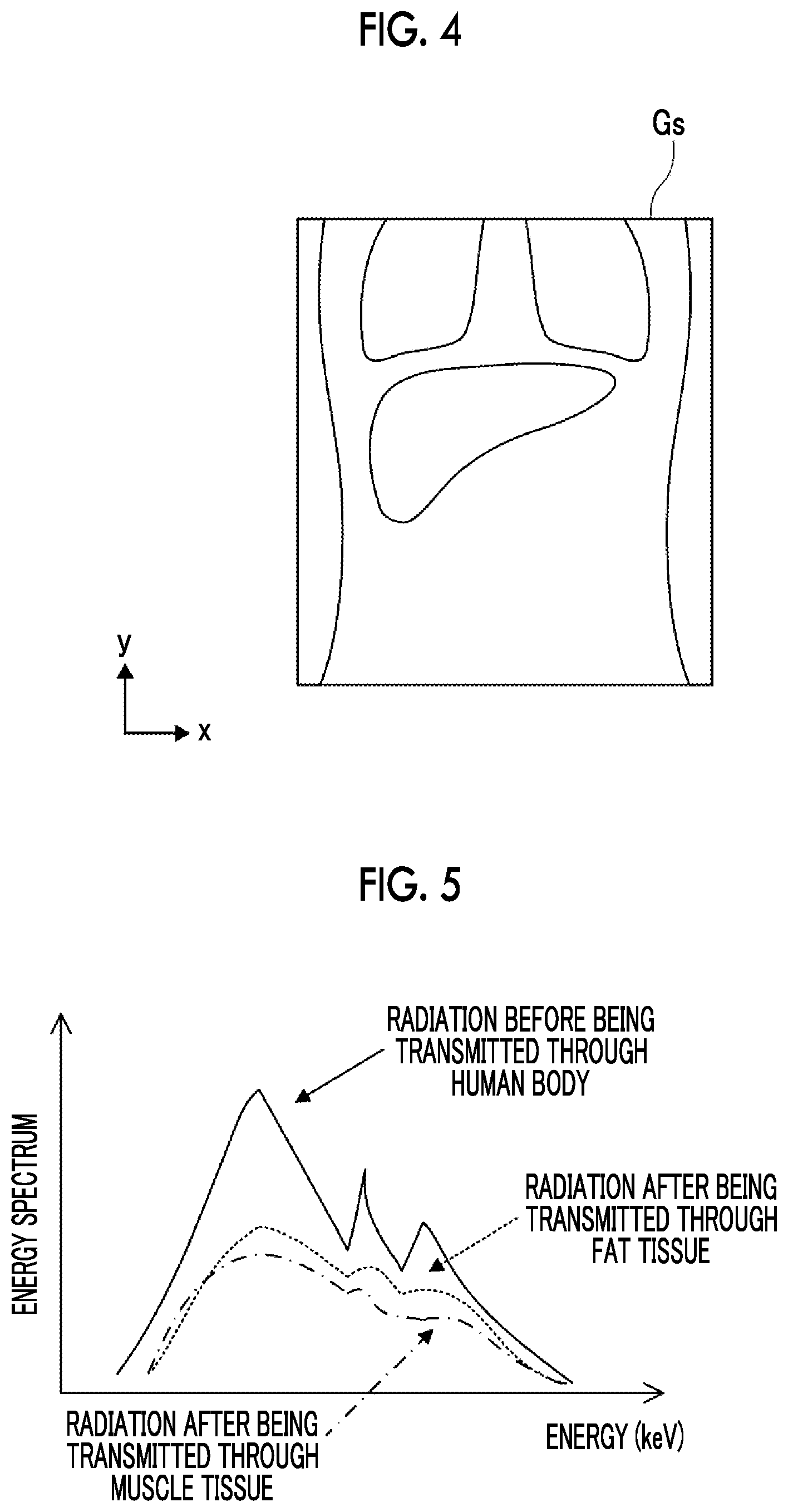 Patent US12588885 Figure 3 – Fat mass derivation device, fat mass derivation method, and fat mass derivation program