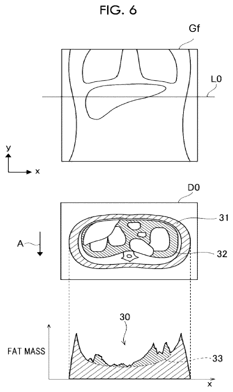 Patent US12588885 Figure 4 – Fat mass derivation device, fat mass derivation method, and fat mass derivation program