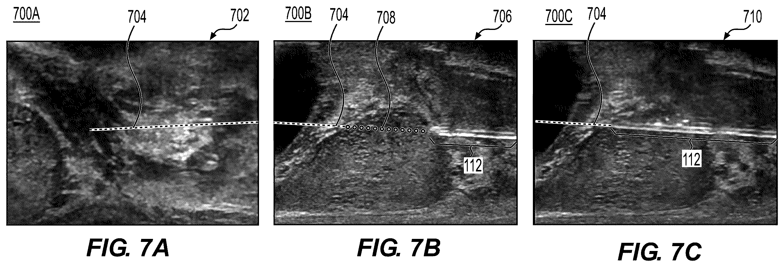 Patent US12588887 Figure 9 – Medical device position sensing components
