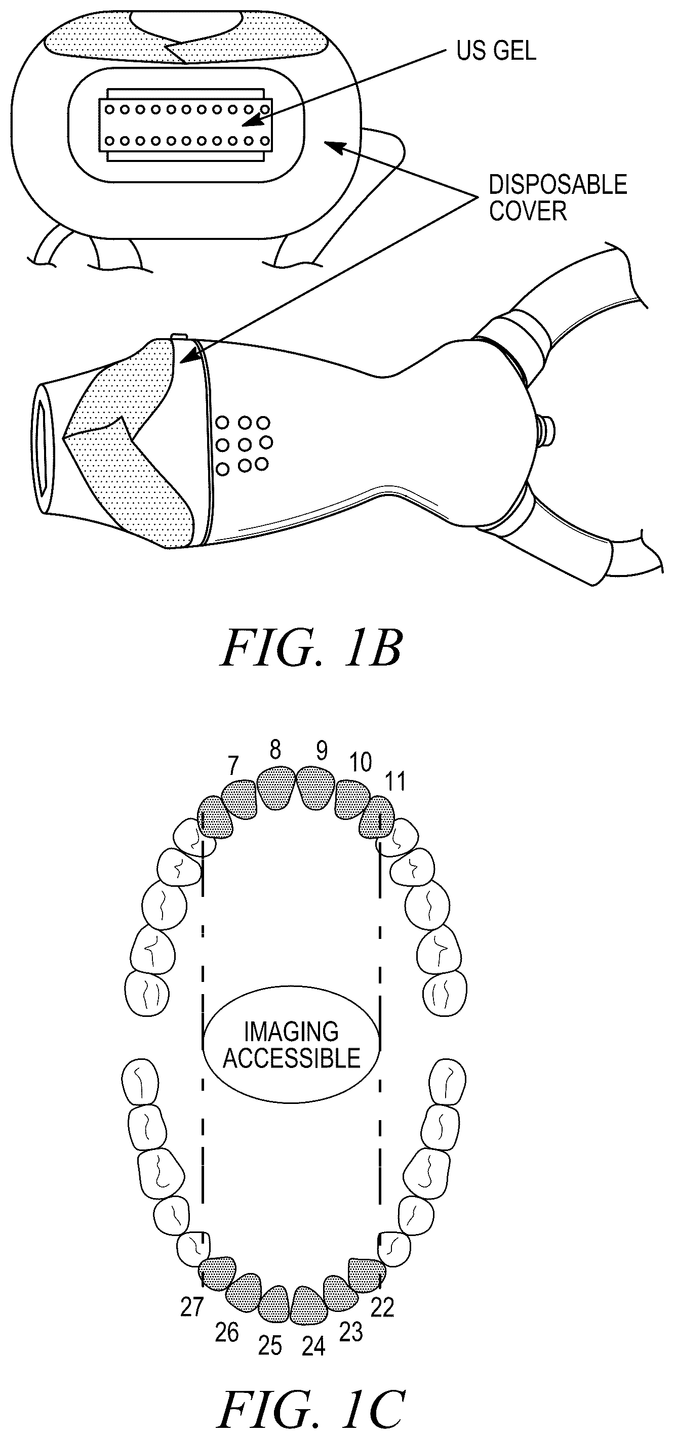 Patent US12588888 Figure 2 – High-resolution ultrasonography of gingival biomarkers for periodontal diagnosis in healthy and diseased subjects