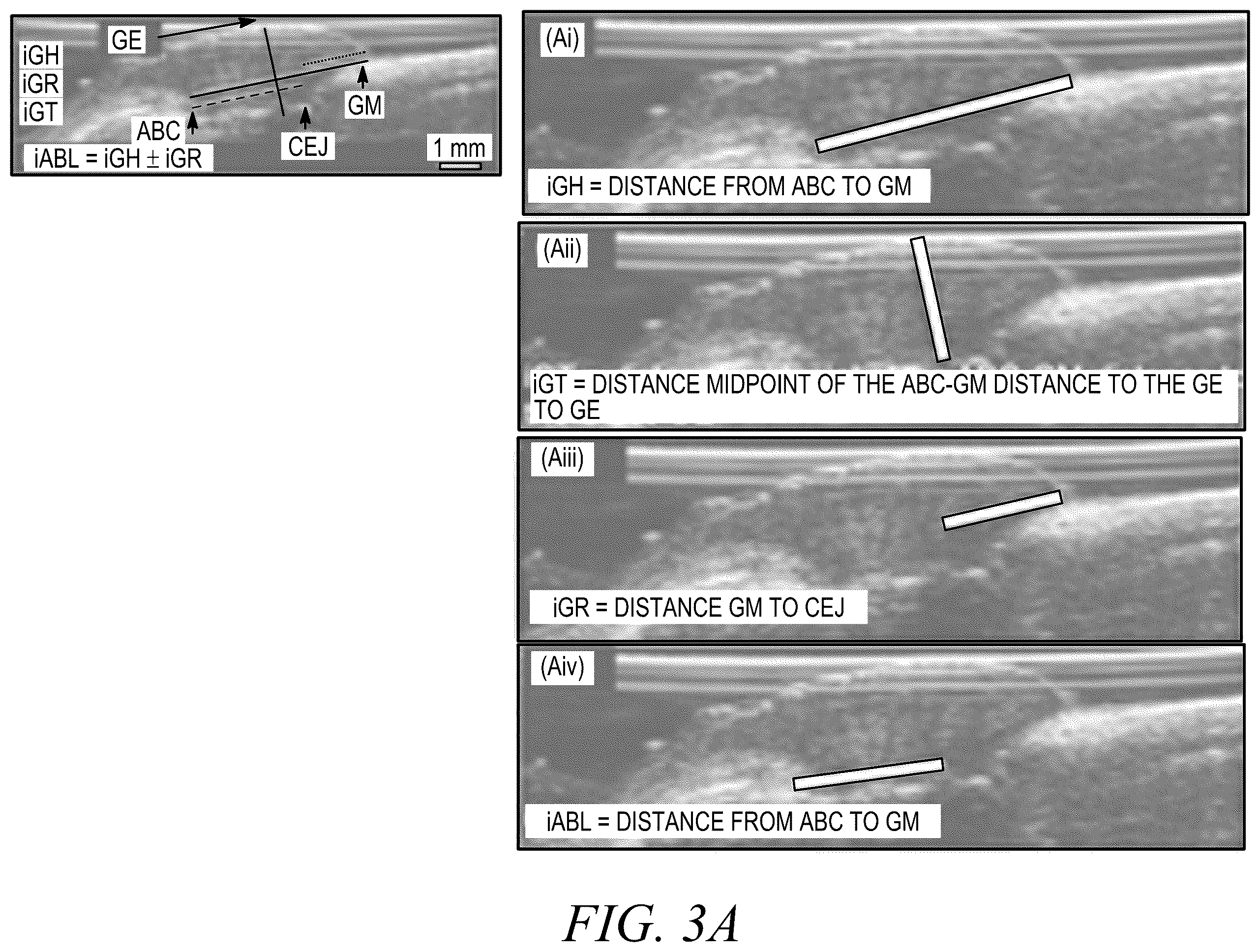 Patent US12588888 Figure 5 – High-resolution ultrasonography of gingival biomarkers for periodontal diagnosis in healthy and diseased subjects