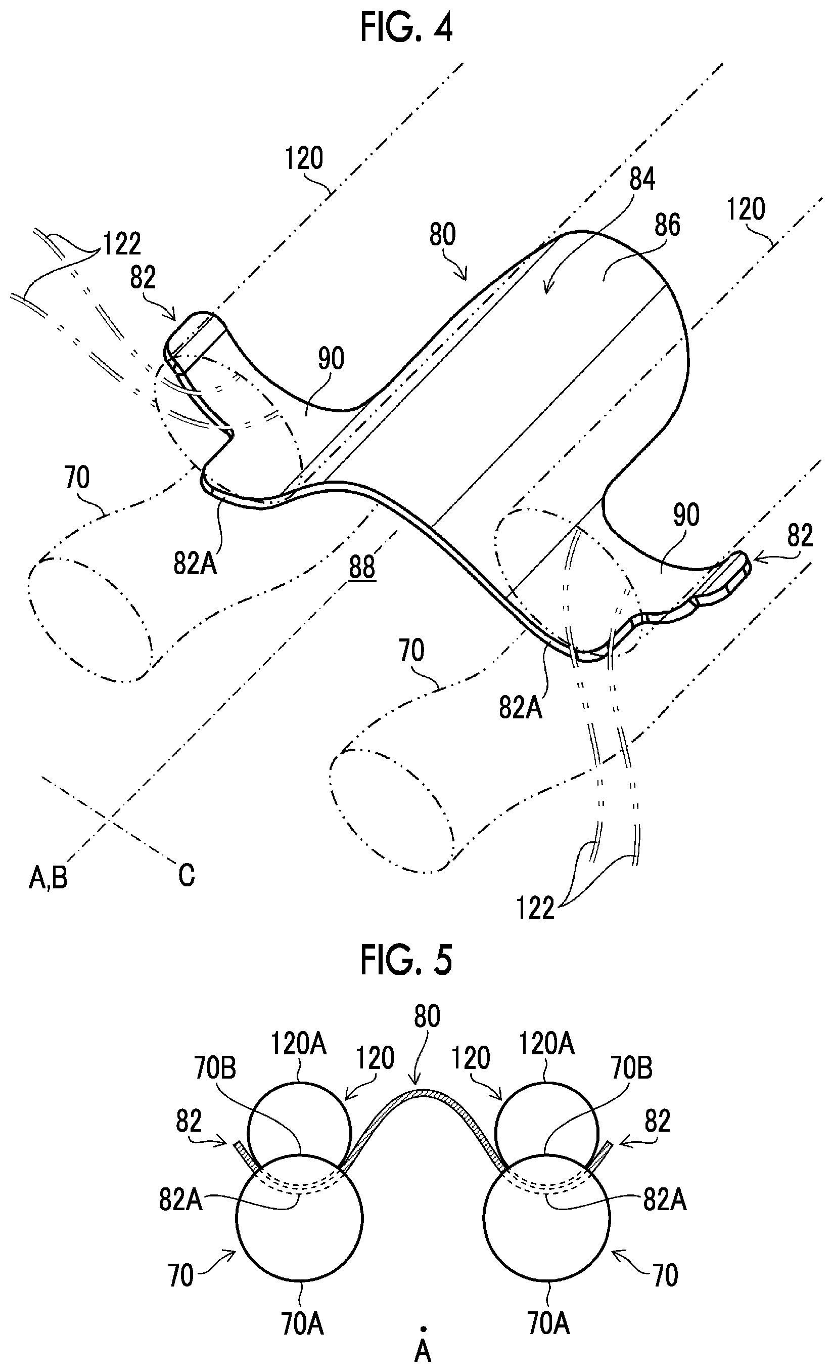 Patent US12588889 Figure 4 – Ultrasonic endoscope