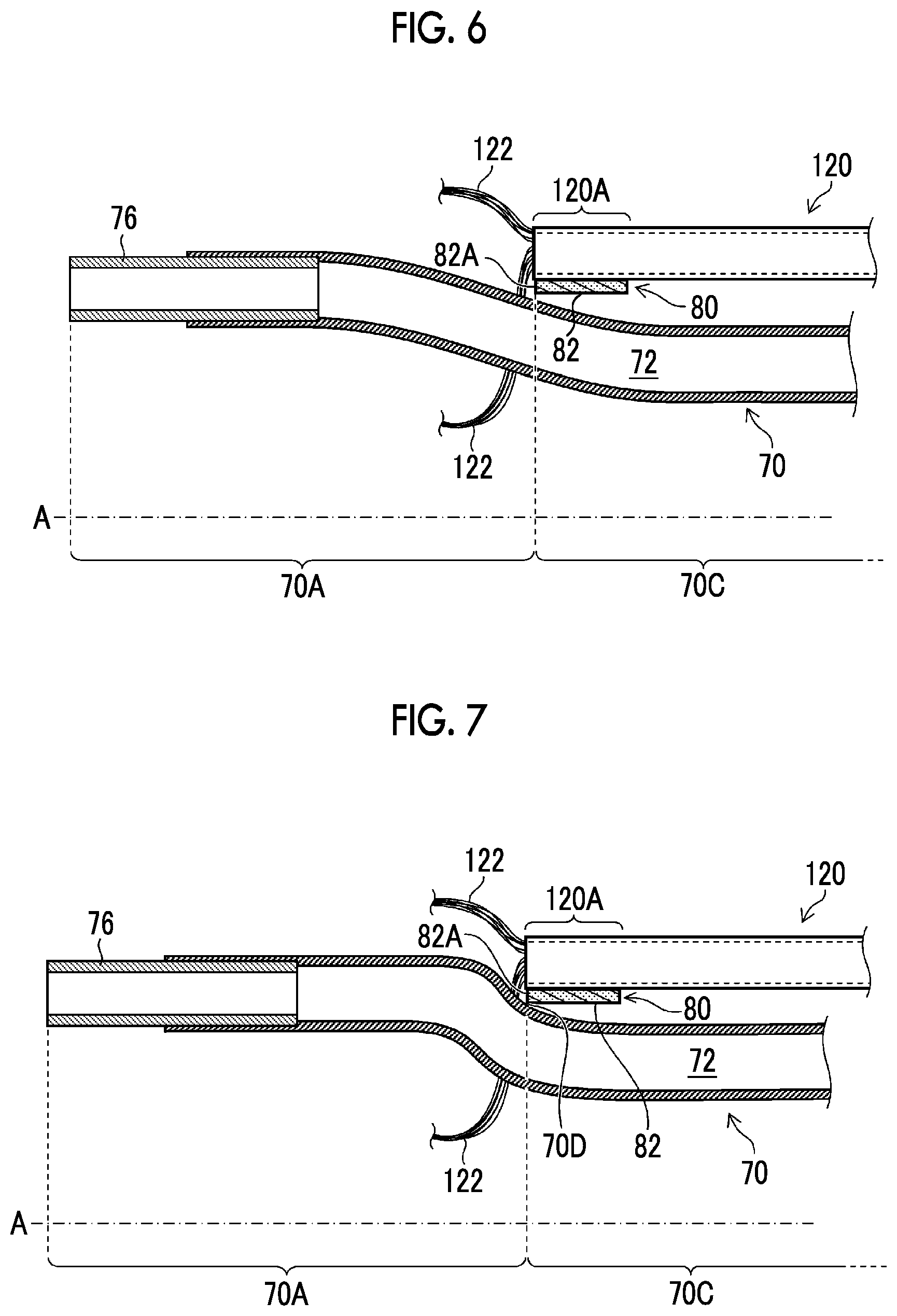 Patent US12588889 Figure 5 – Ultrasonic endoscope