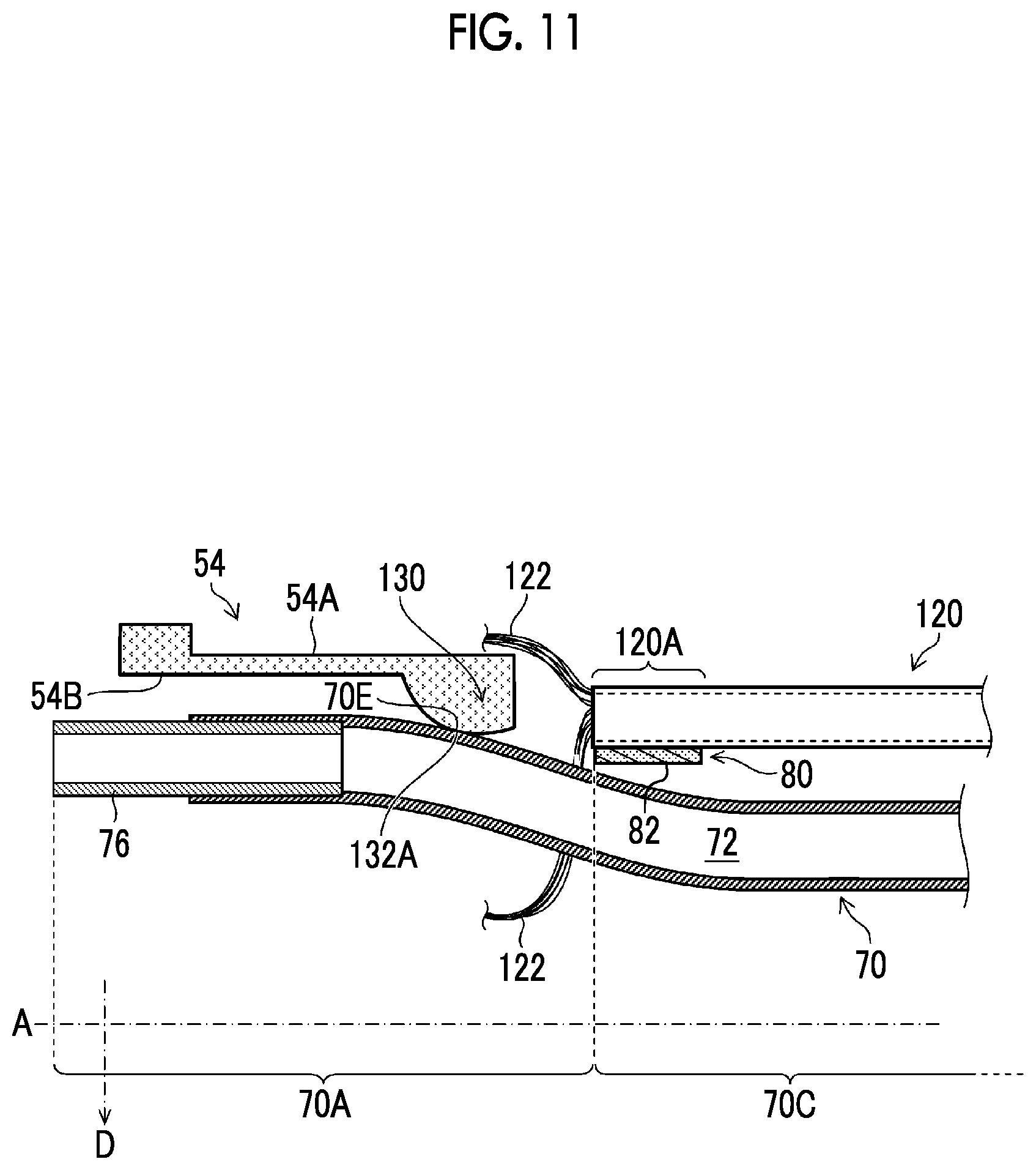 Patent US12588889 Figure 8 – Ultrasonic endoscope