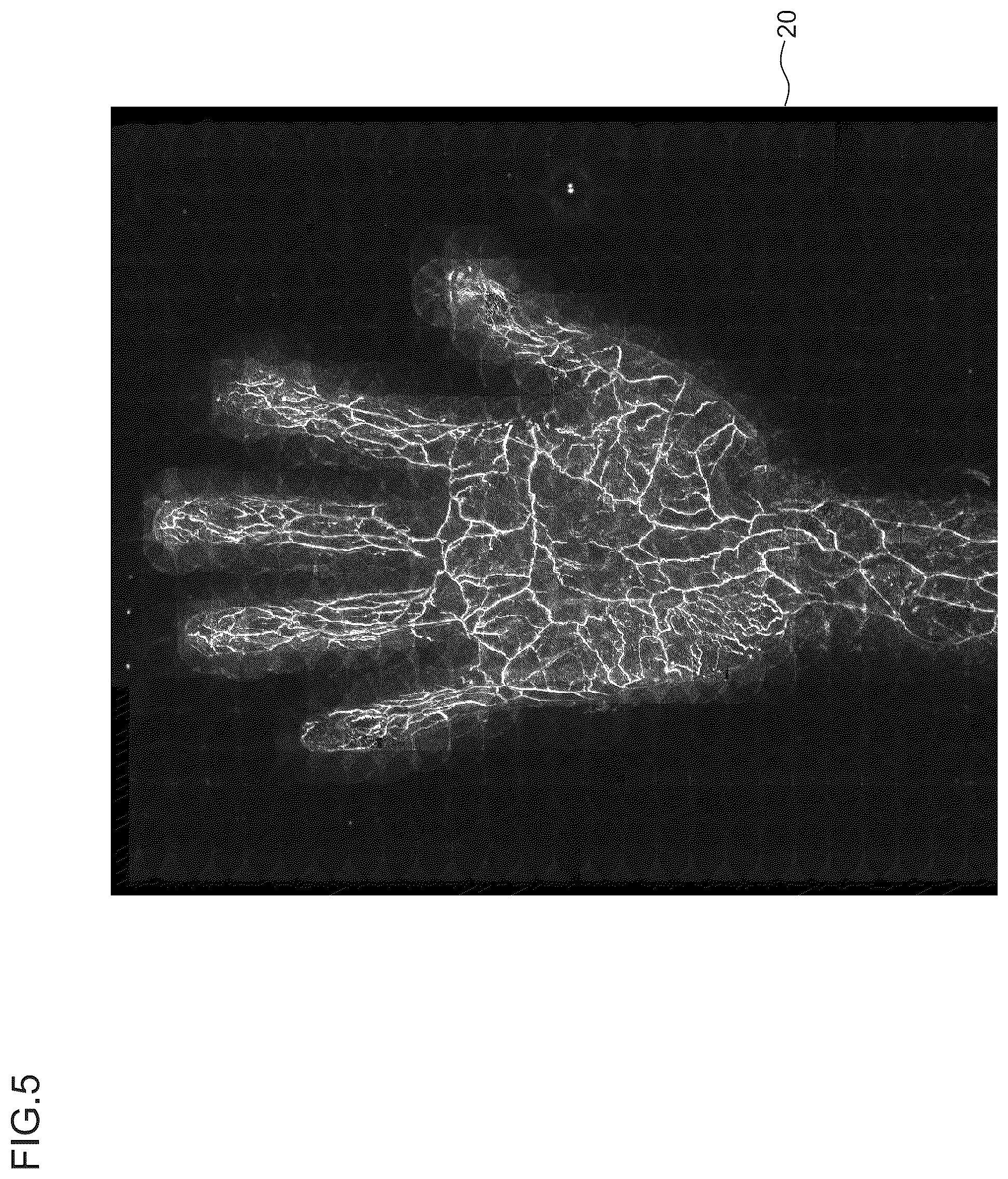 Patent US12588890 Figure 5 – Optimizing acoustical velocity in photoacoustic imaging