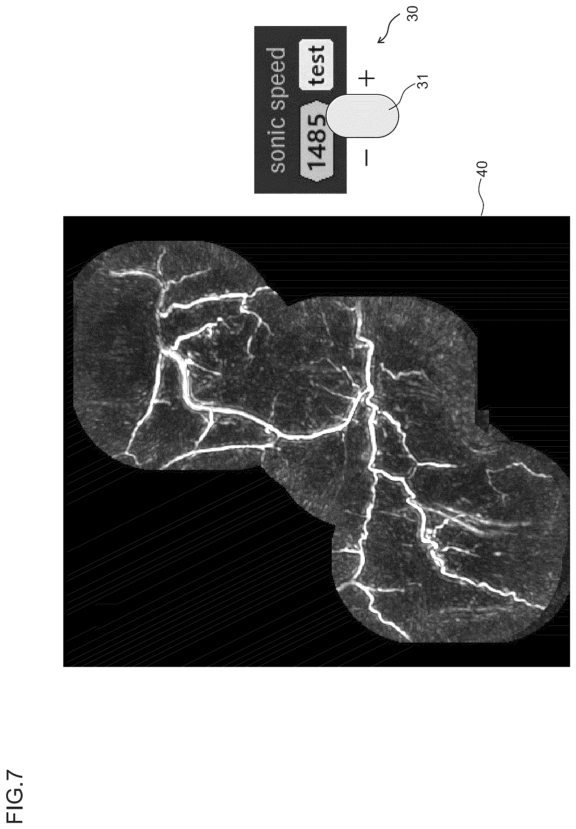 Patent US12588890 Figure 7 – Optimizing acoustical velocity in photoacoustic imaging
