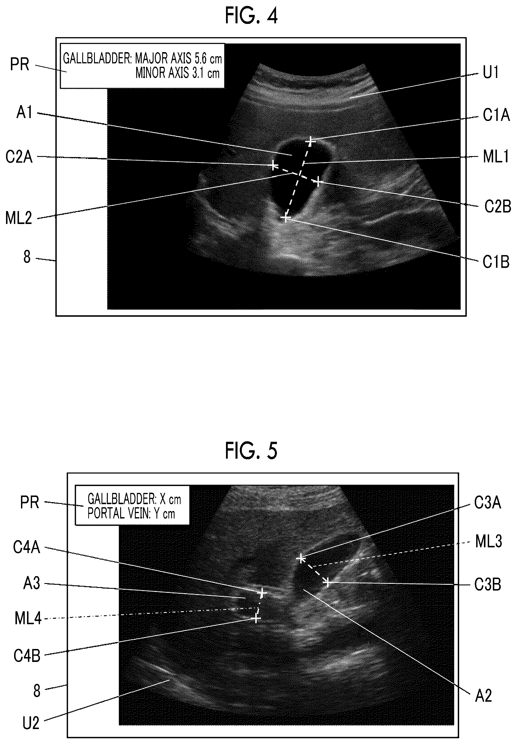 Patent US12588891 Figure 3 – Acoustic wave diagnostic apparatus and method of controlling acoustic wave diagnostic apparatus