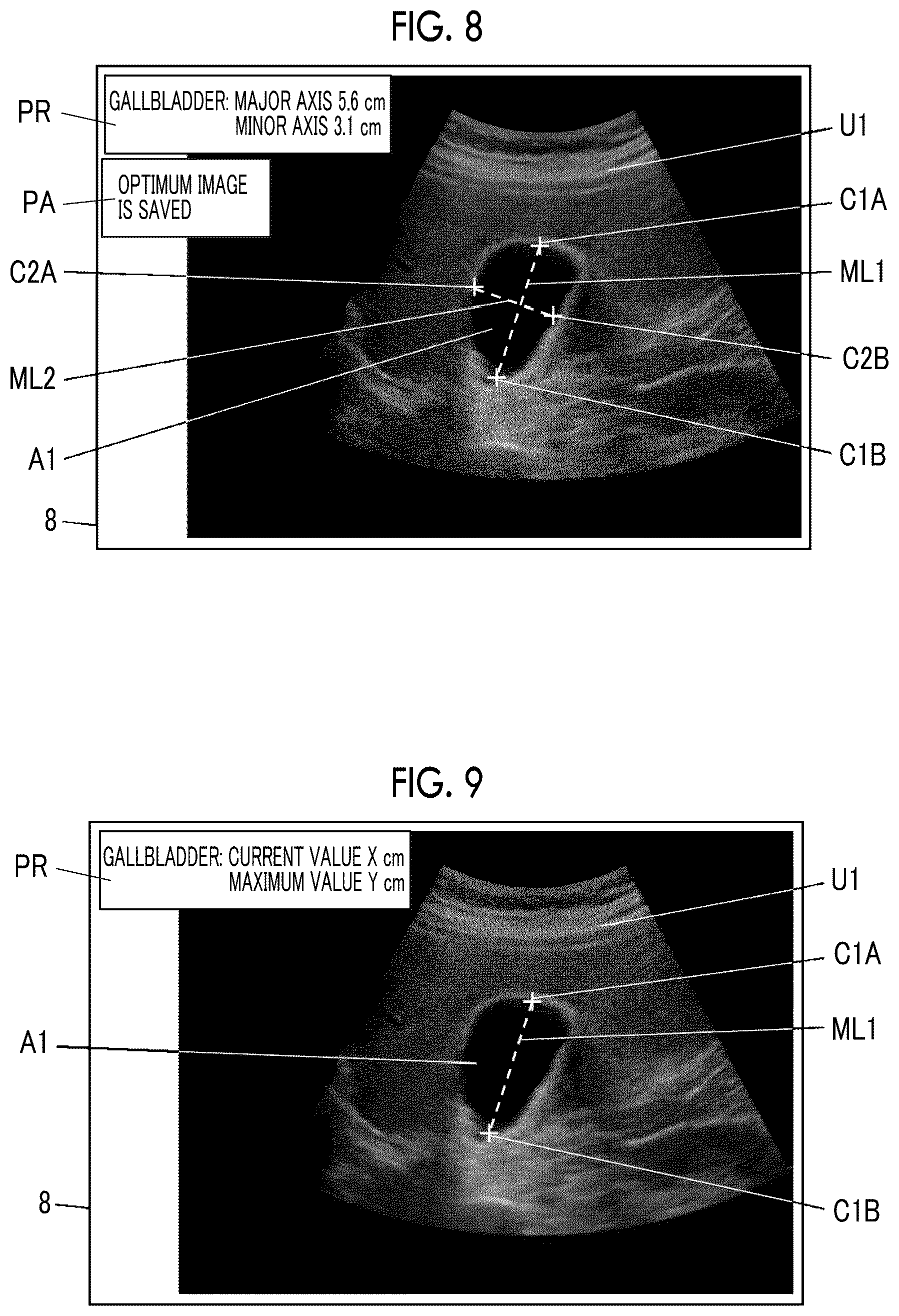 Patent US12588891 Figure 6 – Acoustic wave diagnostic apparatus and method of controlling acoustic wave diagnostic apparatus