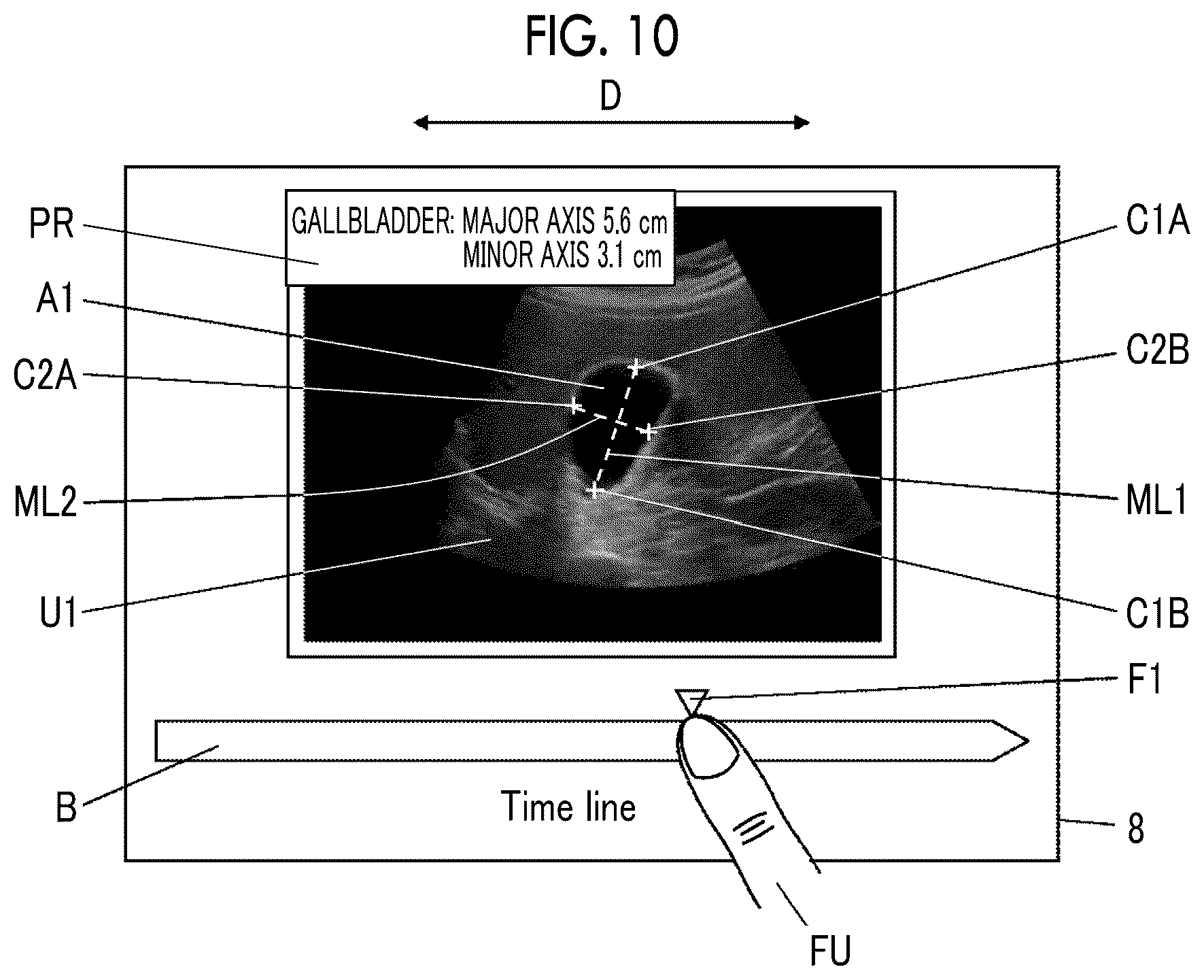 Patent US12588891 Figure 7 – Acoustic wave diagnostic apparatus and method of controlling acoustic wave diagnostic apparatus