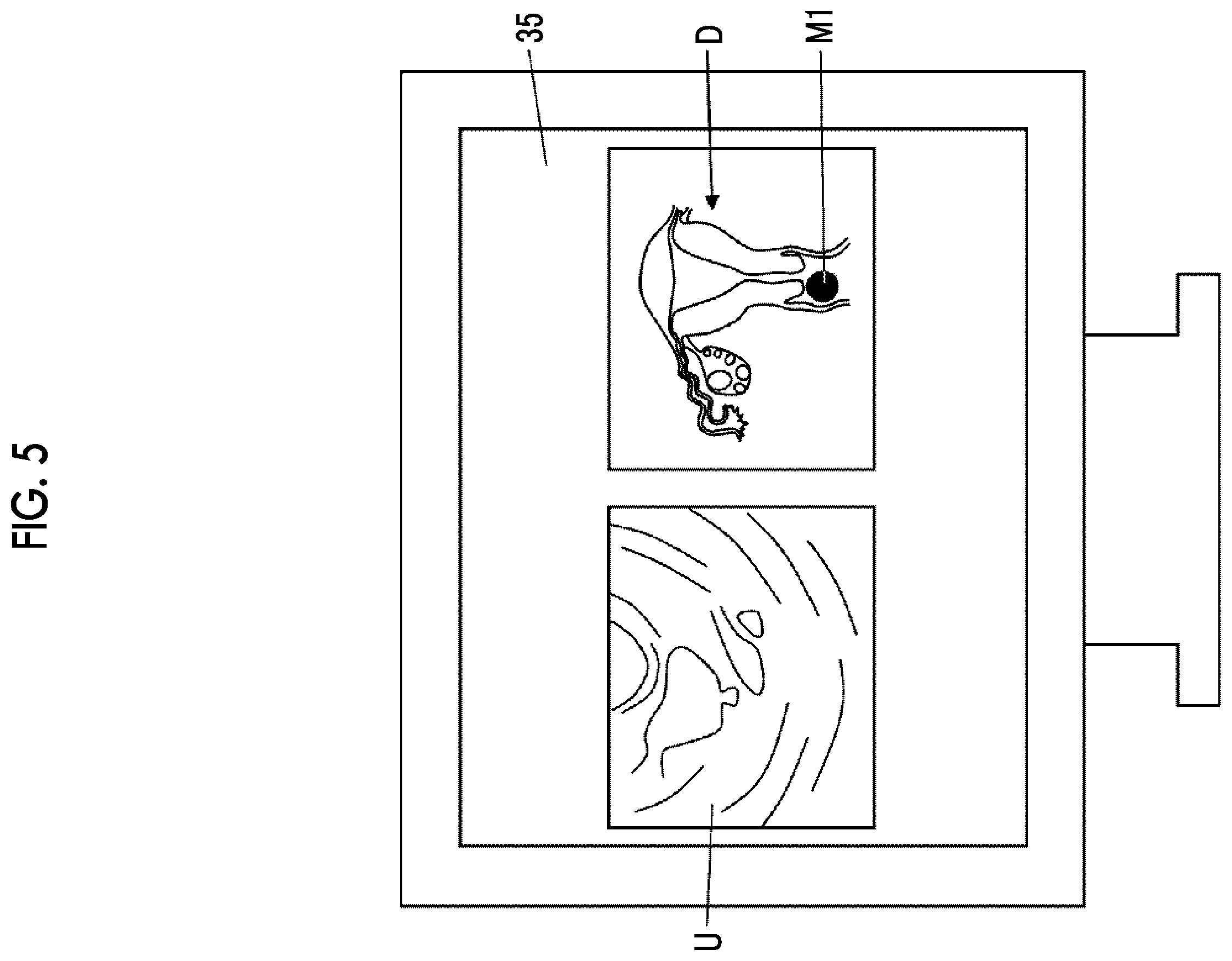 Patent US12588892 Figure 4 – Ultrasound diagnostic system and control method of ultrasound diagnostic system