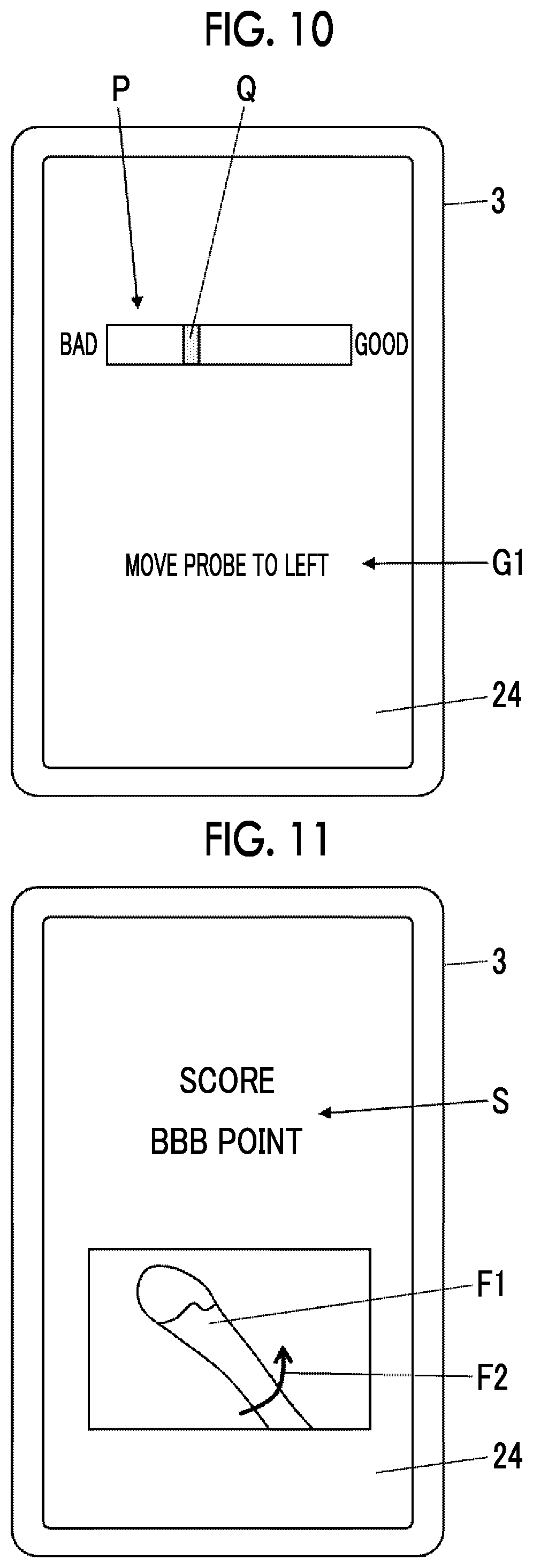 Patent US12588892 Figure 7 – Ultrasound diagnostic system and control method of ultrasound diagnostic system