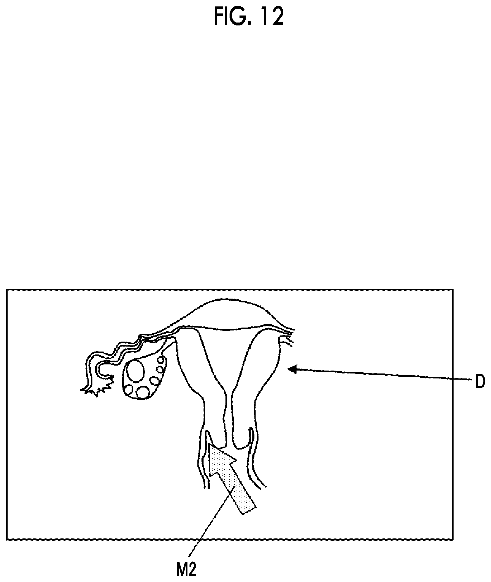 Patent US12588892 Figure 8 – Ultrasound diagnostic system and control method of ultrasound diagnostic system