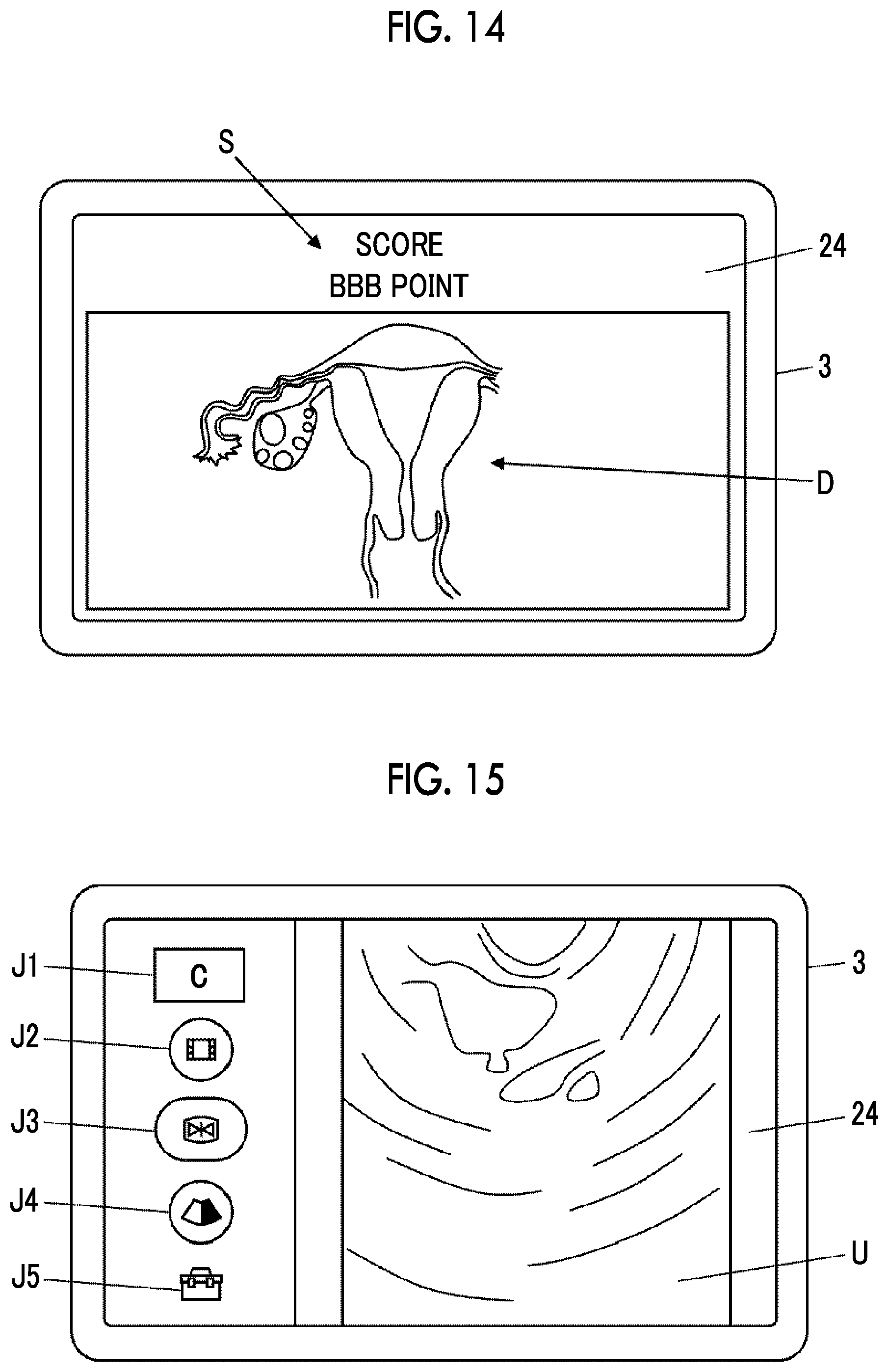 Patent US12588892 Figure 10 – Ultrasound diagnostic system and control method of ultrasound diagnostic system