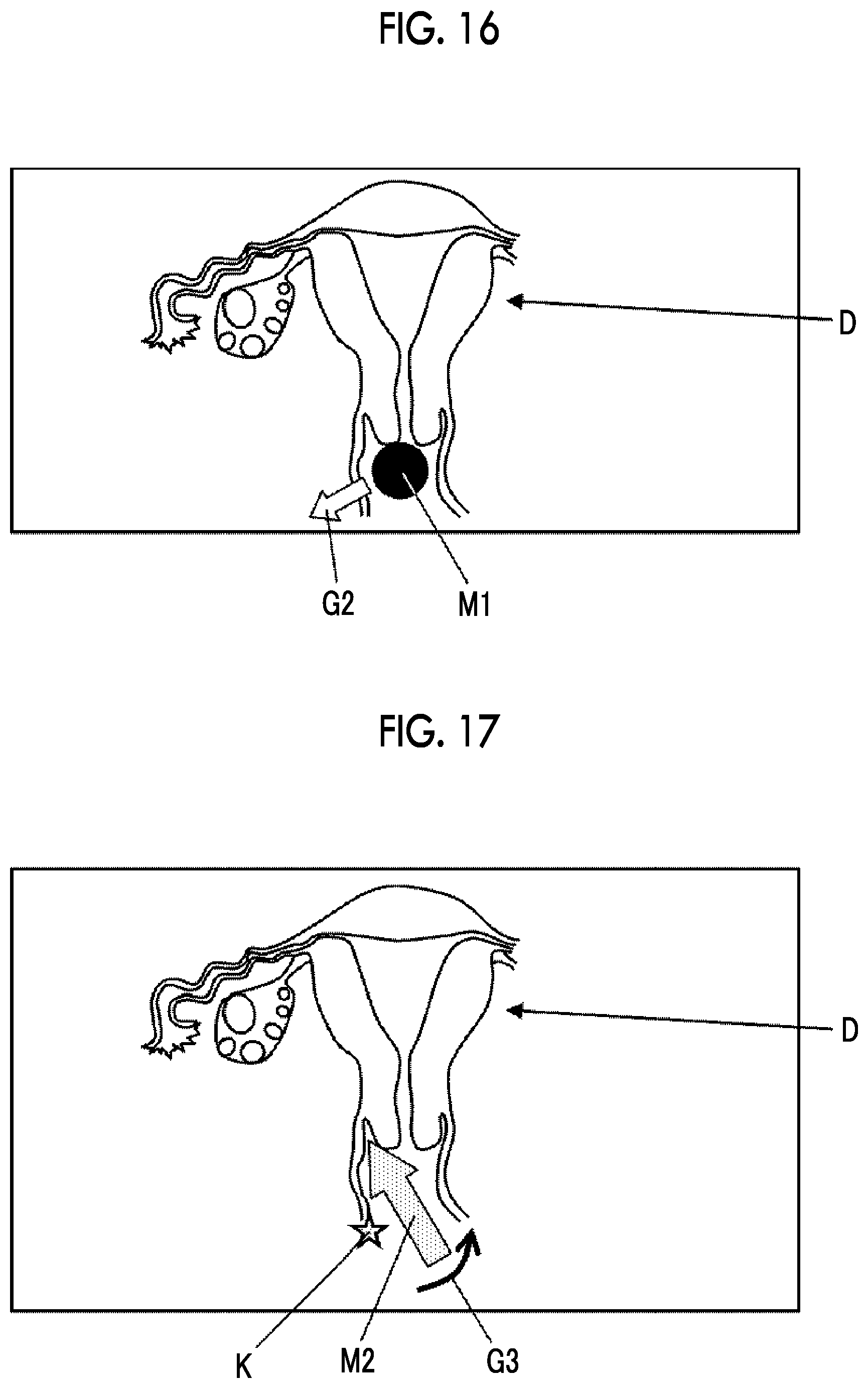 Patent US12588892 Figure 11 – Ultrasound diagnostic system and control method of ultrasound diagnostic system