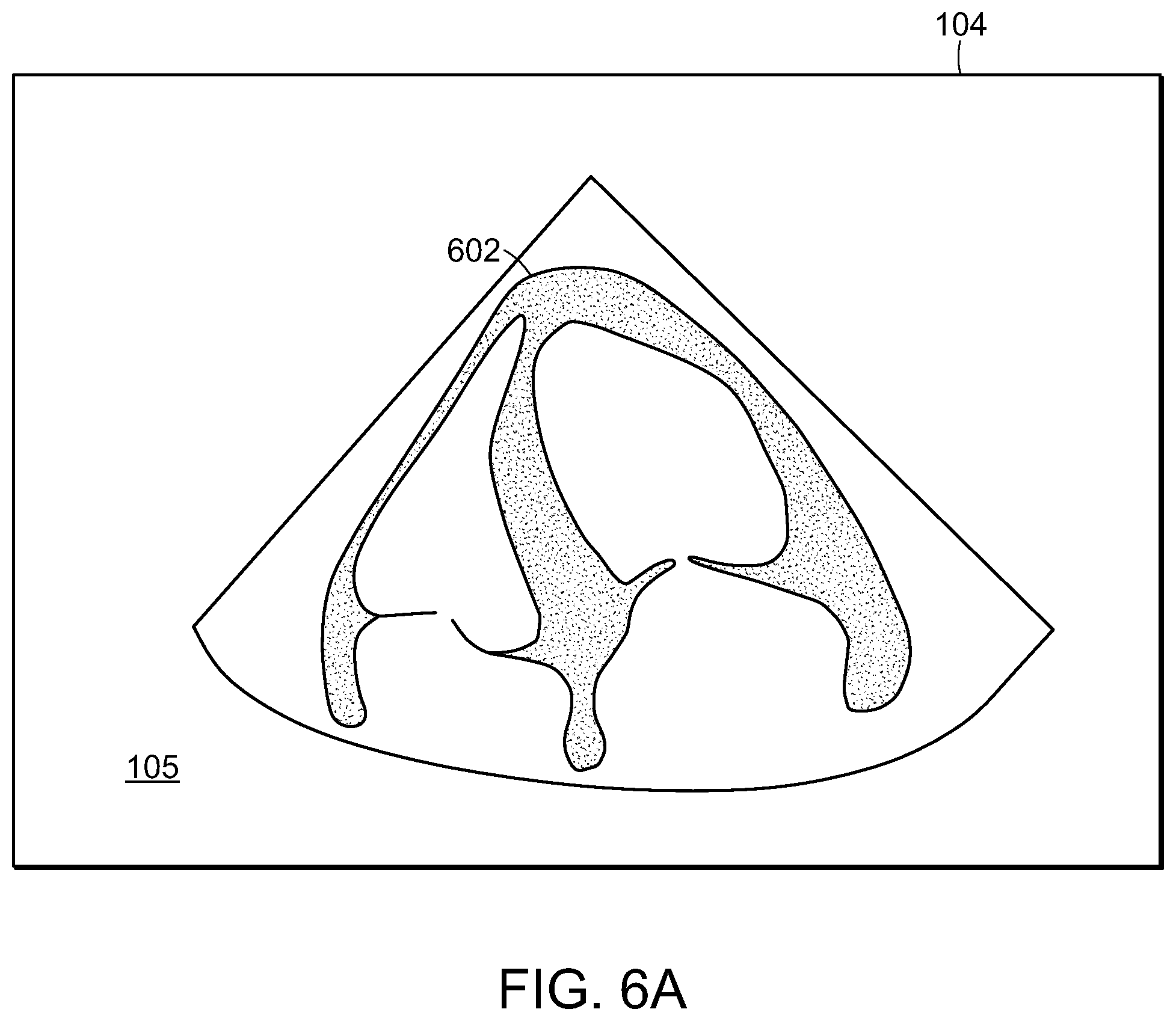 Patent US12588893 Figure 10 – Tablet ultrasound system