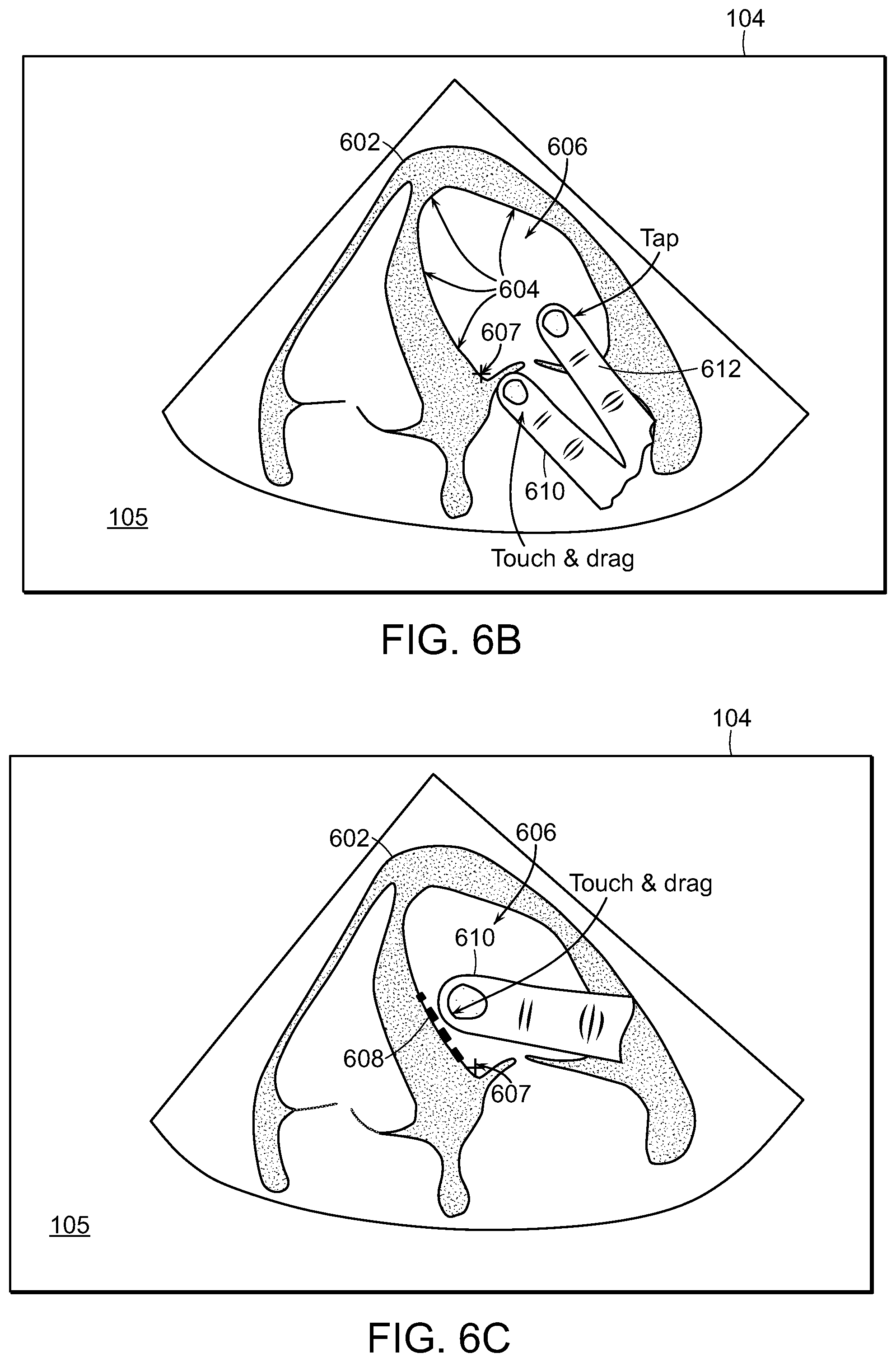 Patent US12588893 Figure 11 – Tablet ultrasound system