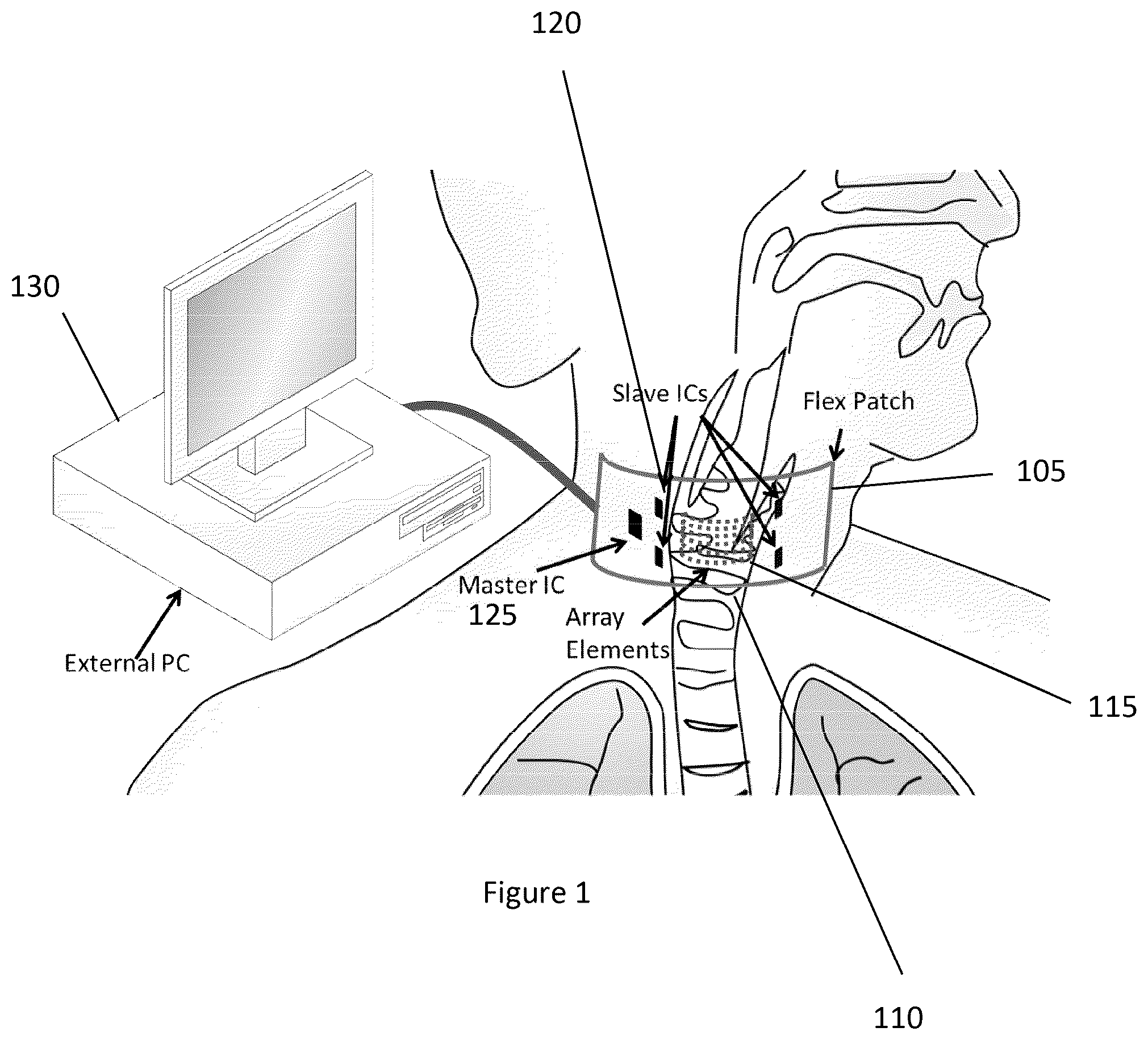 Patent US12588895 — System, method, computer-accessible medium and apparatus for flexible two-dimensional ultrasound phased array — Figure 1
