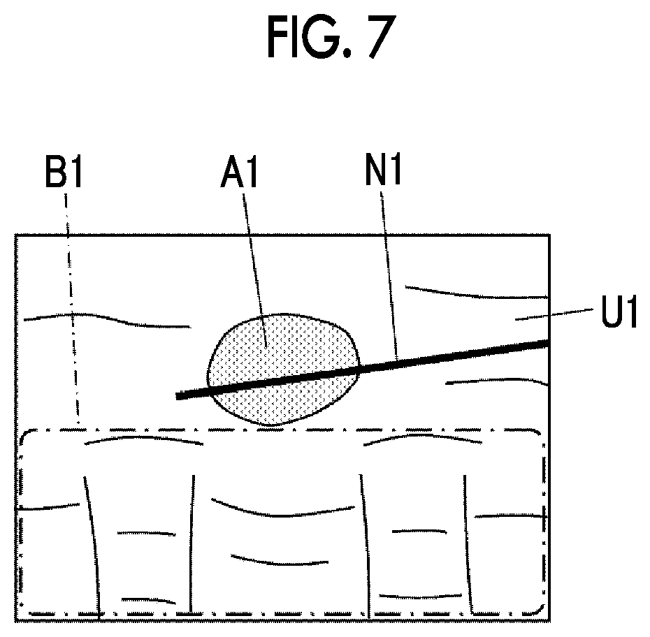 Patent US12588896 Figure 4 – Ultrasound diagnostic apparatus and control method of ultrasound diagnostic apparatus