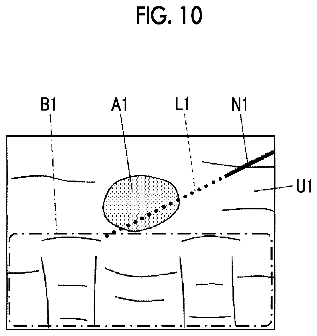 Patent US12588896 Figure 7 – Ultrasound diagnostic apparatus and control method of ultrasound diagnostic apparatus