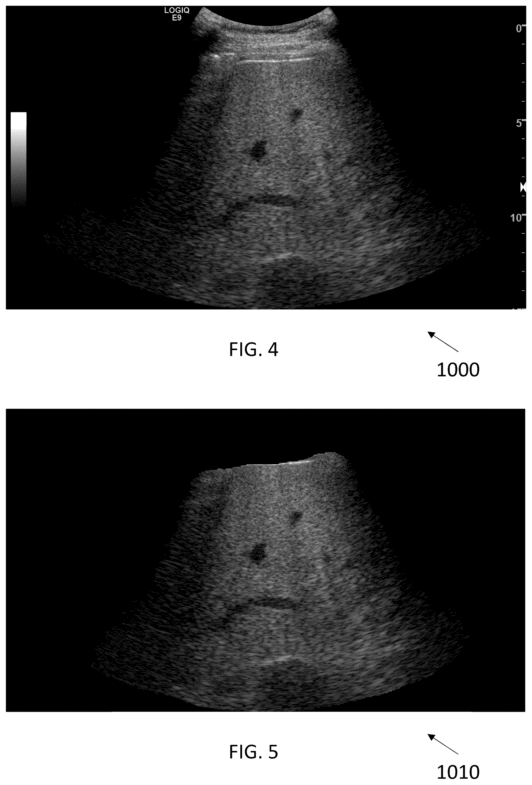 Patent US12588898 Figure 4 – Ultrasound imaging techniques for shear-wave elastography