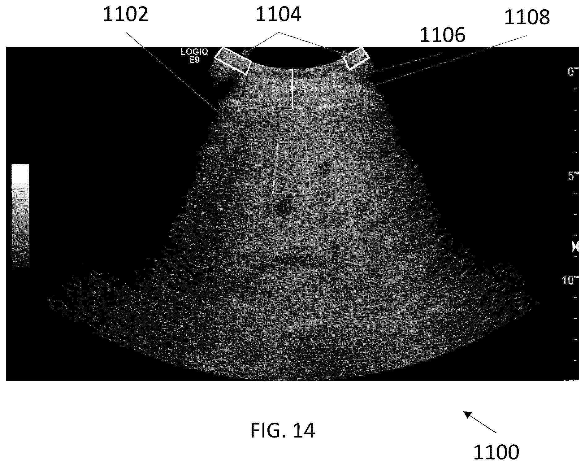 Patent US12588898 Figure 9 – Ultrasound imaging techniques for shear-wave elastography