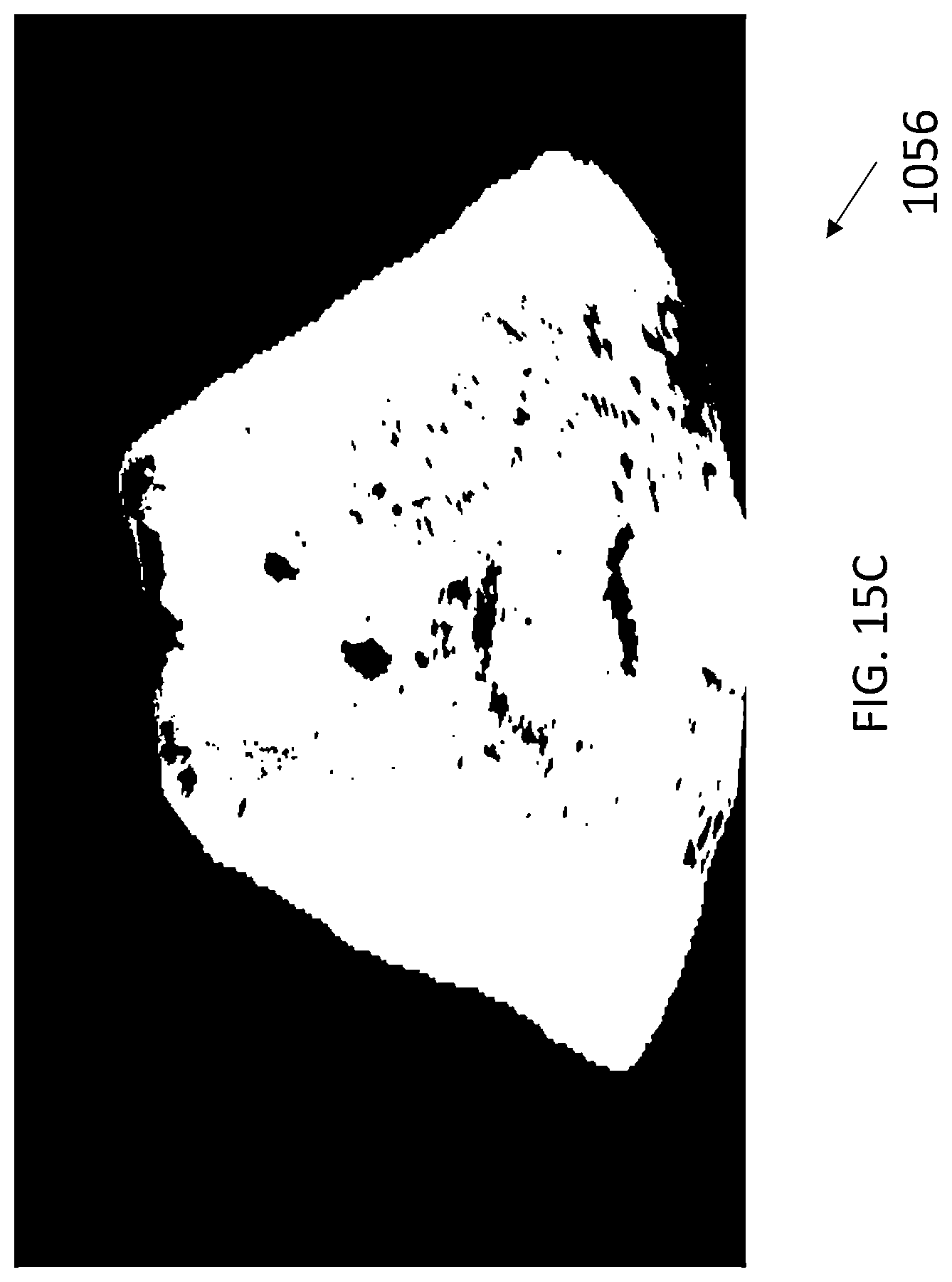 Patent US12588898 Figure 11 – Ultrasound imaging techniques for shear-wave elastography