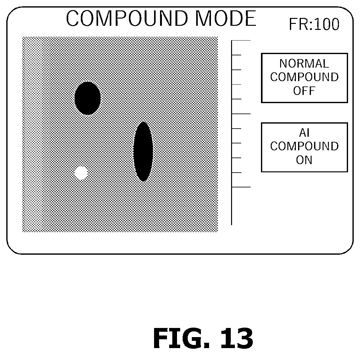 Patent US12588899 Figure 13 – Ultrasonic diagnostic apparatus, learning apparatus, and image processing method