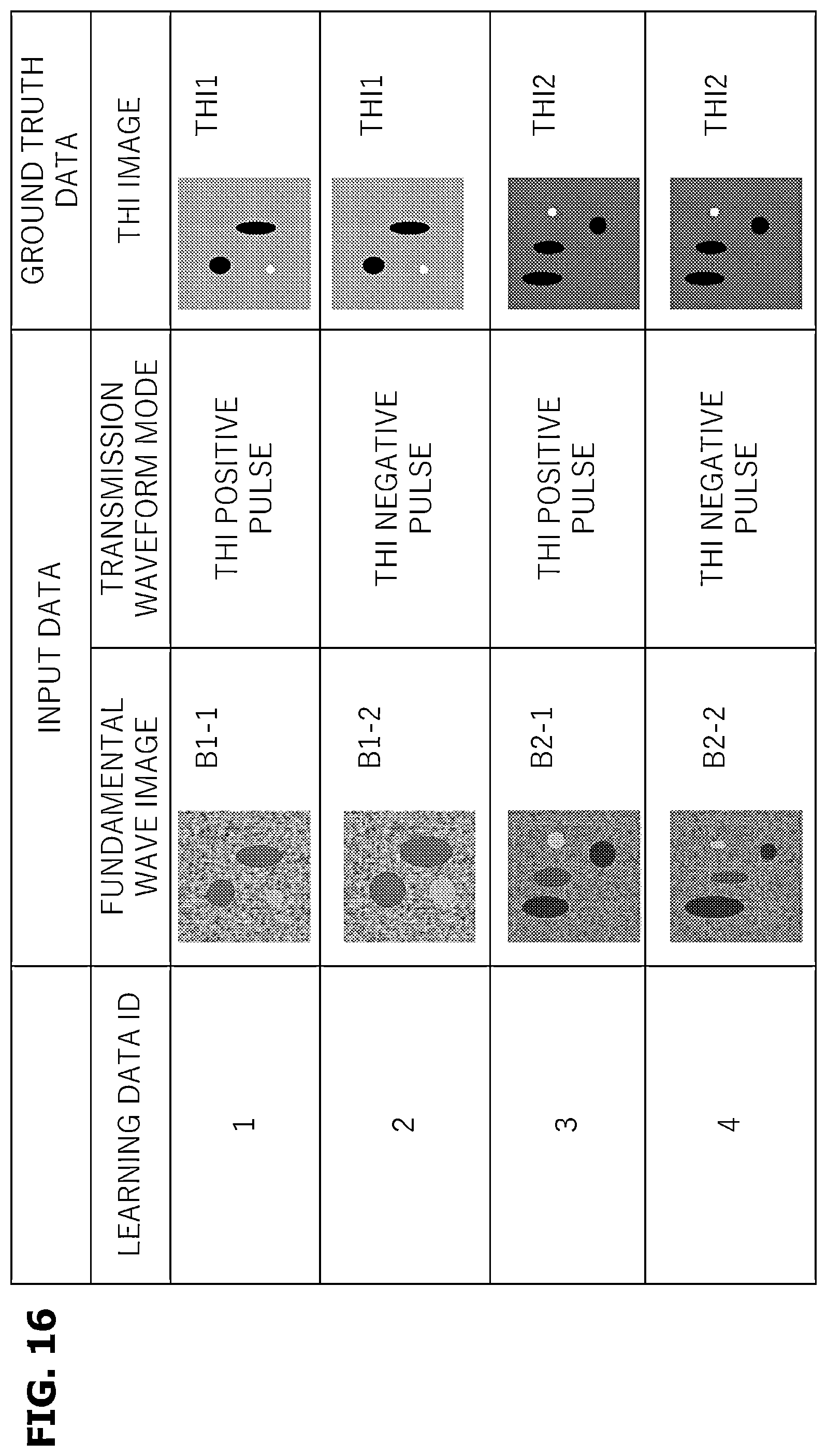 Patent US12588899 Figure 16 – Ultrasonic diagnostic apparatus, learning apparatus, and image processing method