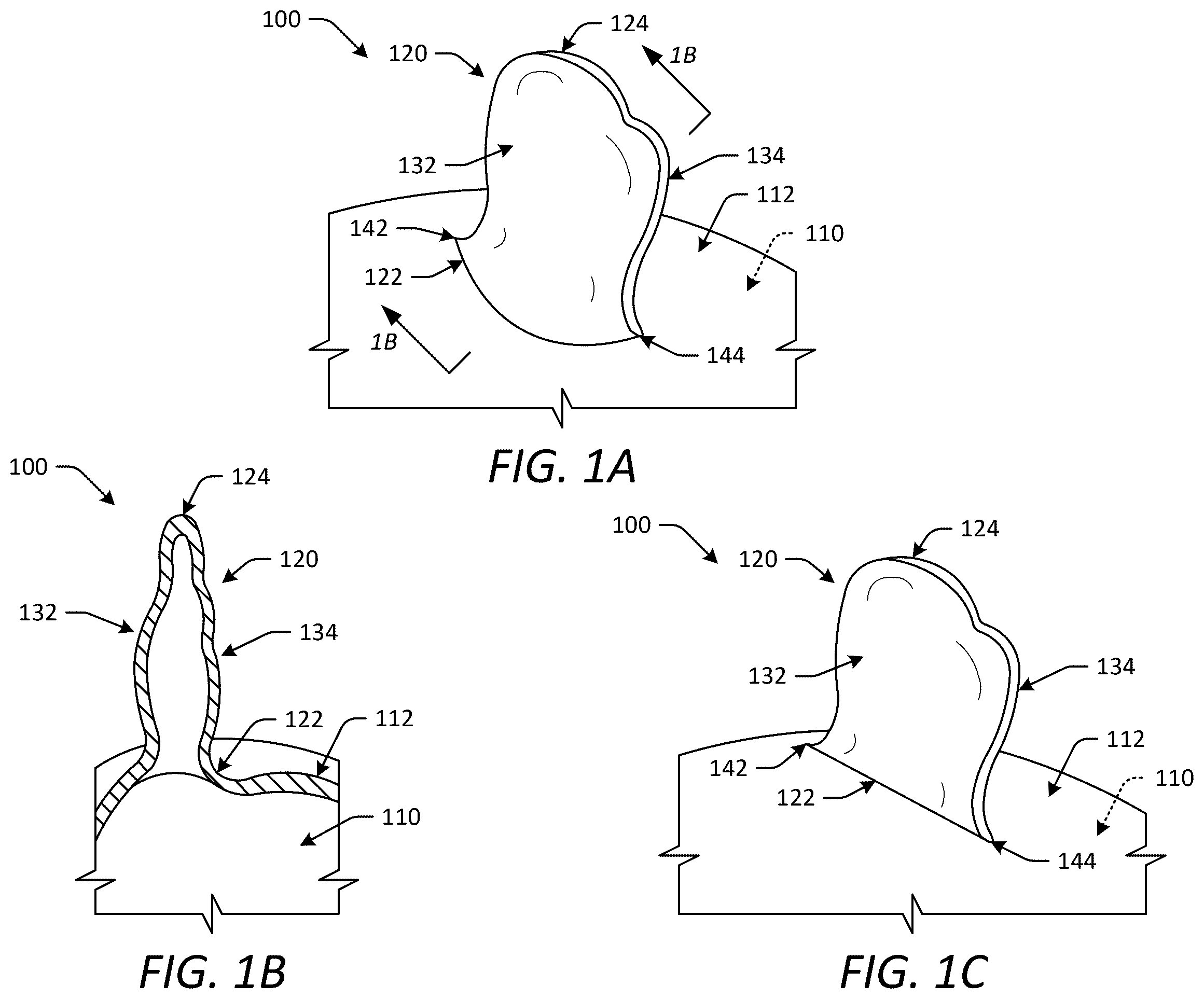 Patent US12588902 Figure 1 – Occlusion devices and methods having lateral pockets or sleeves