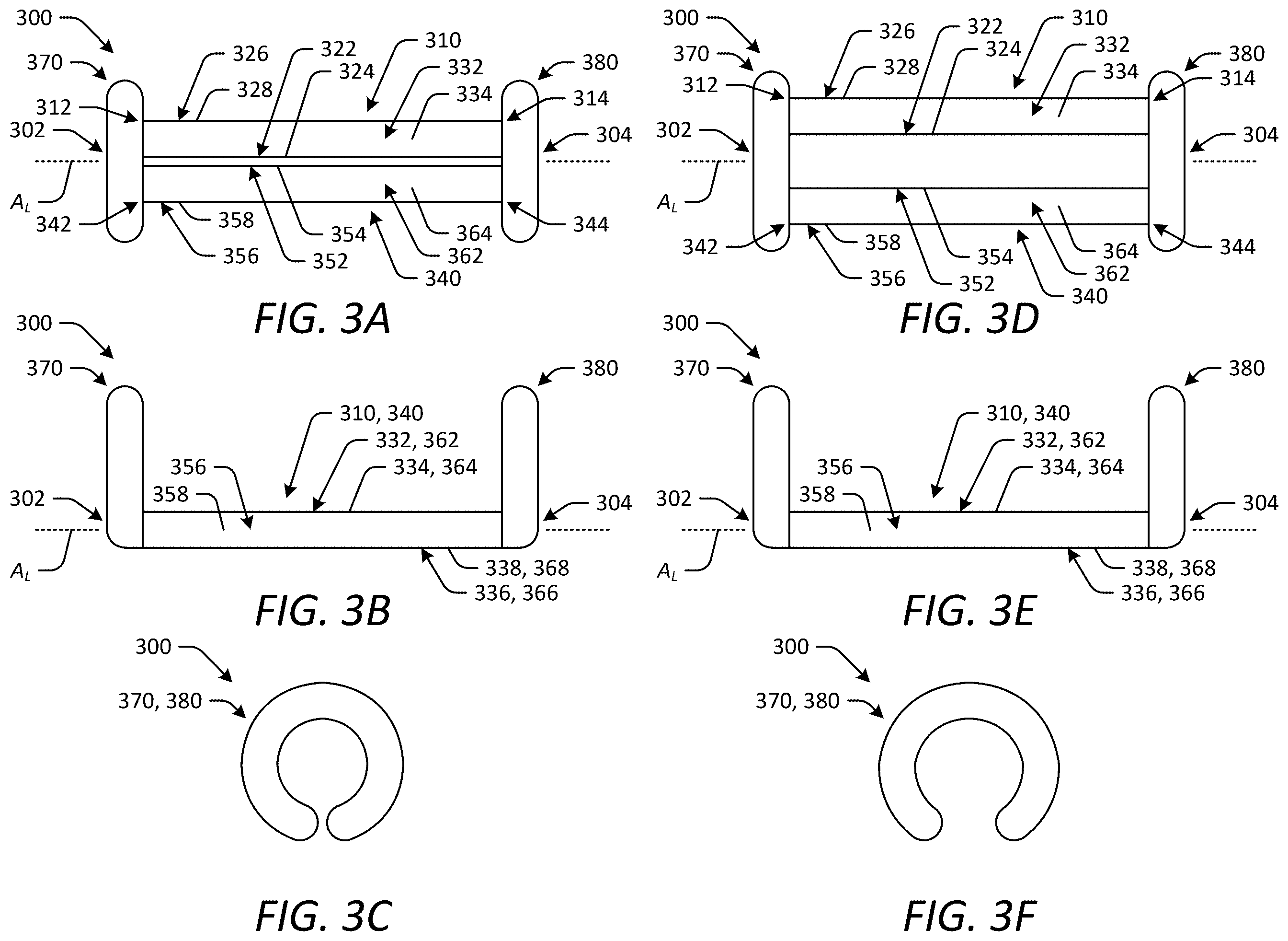 Patent US12588902 Figure 4 – Occlusion devices and methods having lateral pockets or sleeves