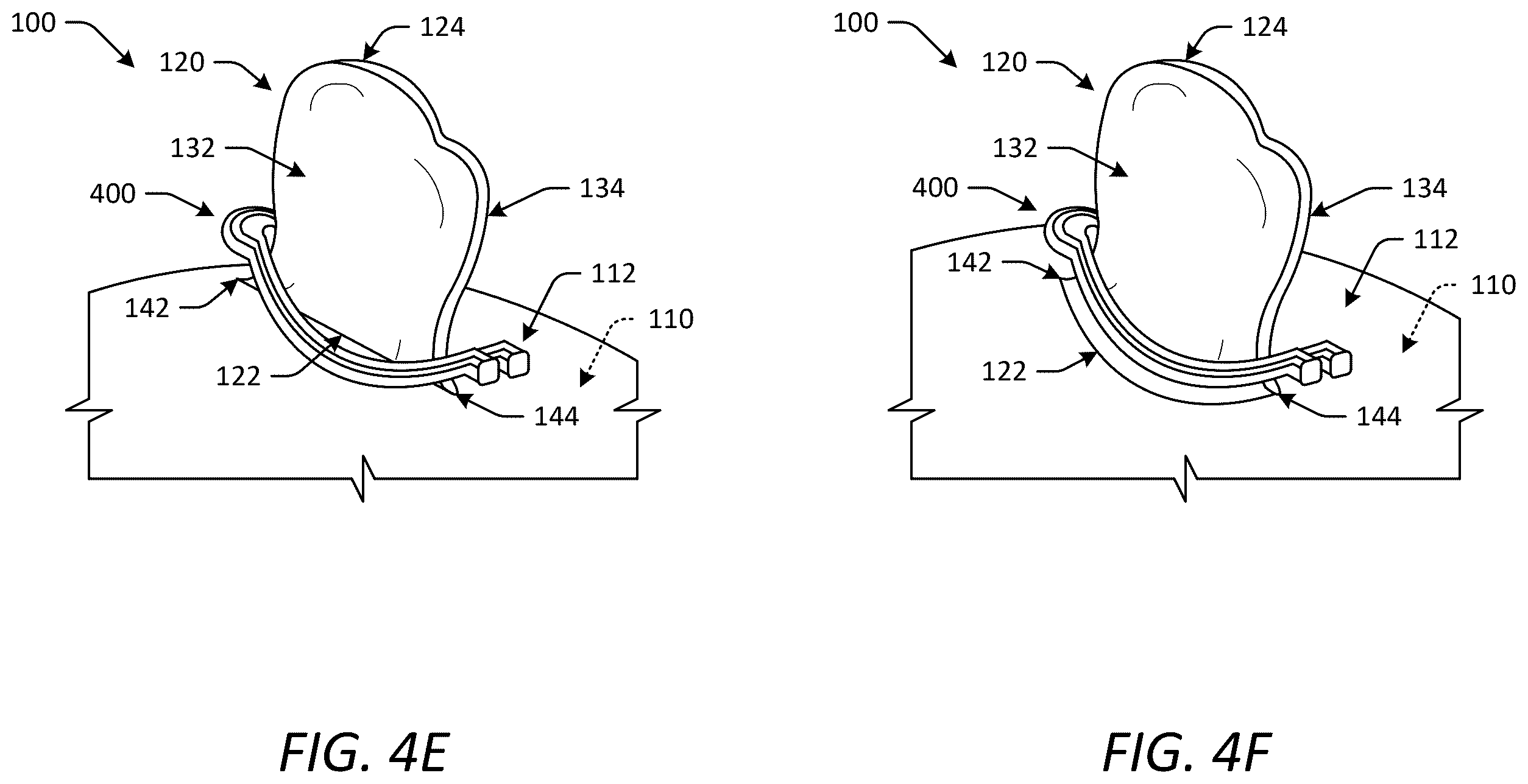 Patent US12588902 Figure 6 – Occlusion devices and methods having lateral pockets or sleeves
