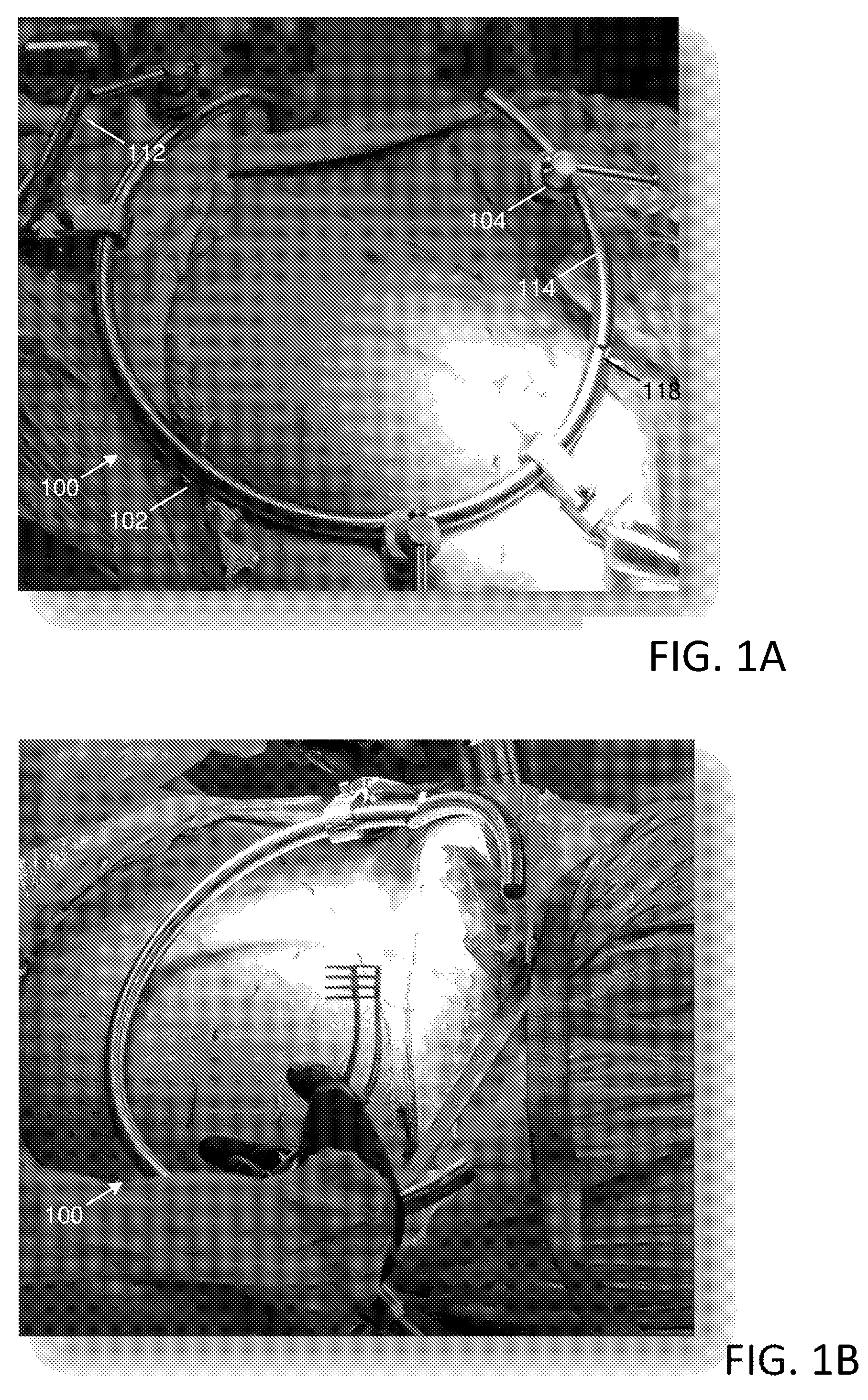Patent US12588903 Figure 1 – Anterior to the psoas surgical access system and a modified surgical approach technique