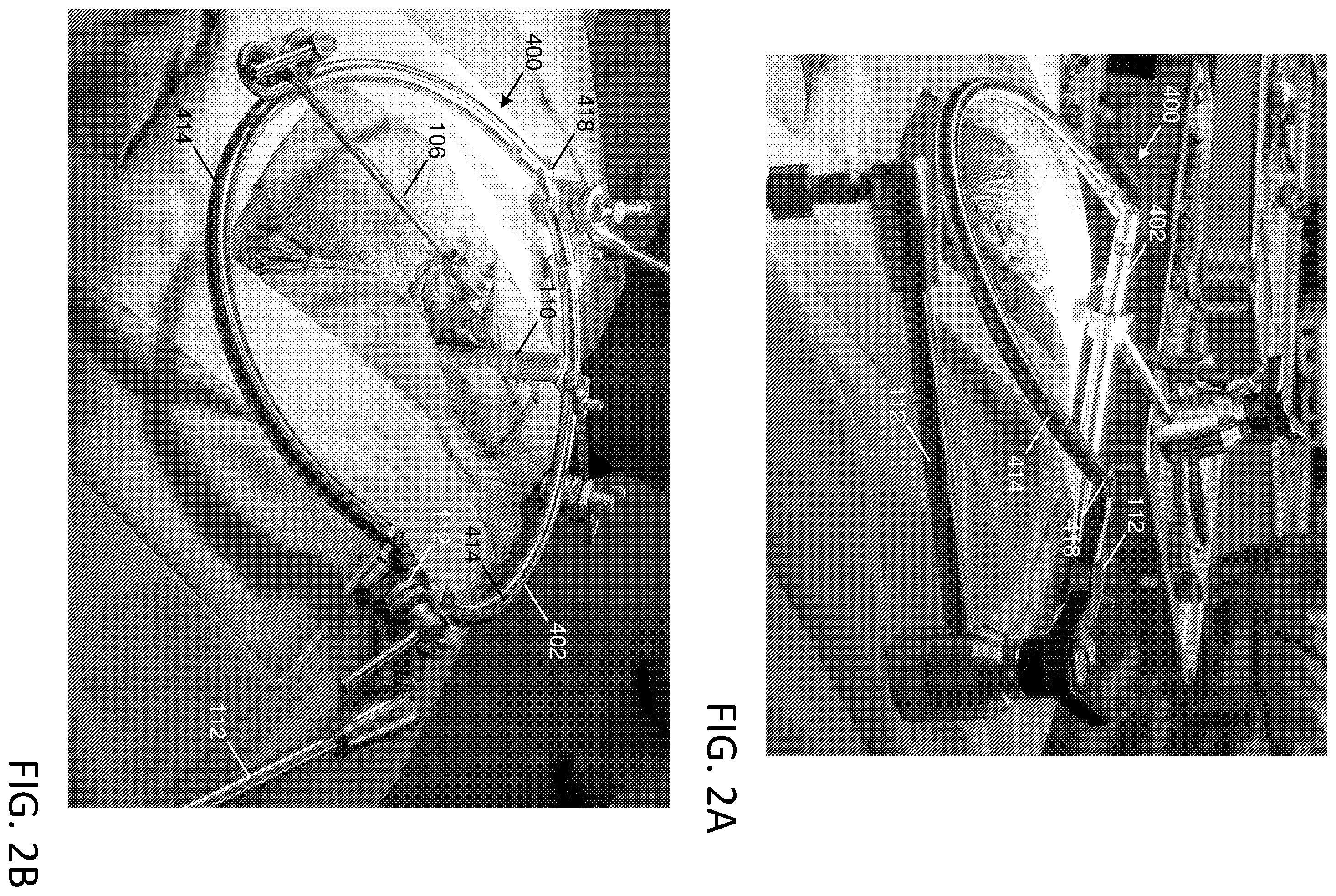 Patent US12588903 Figure 3 – Anterior to the psoas surgical access system and a modified surgical approach technique