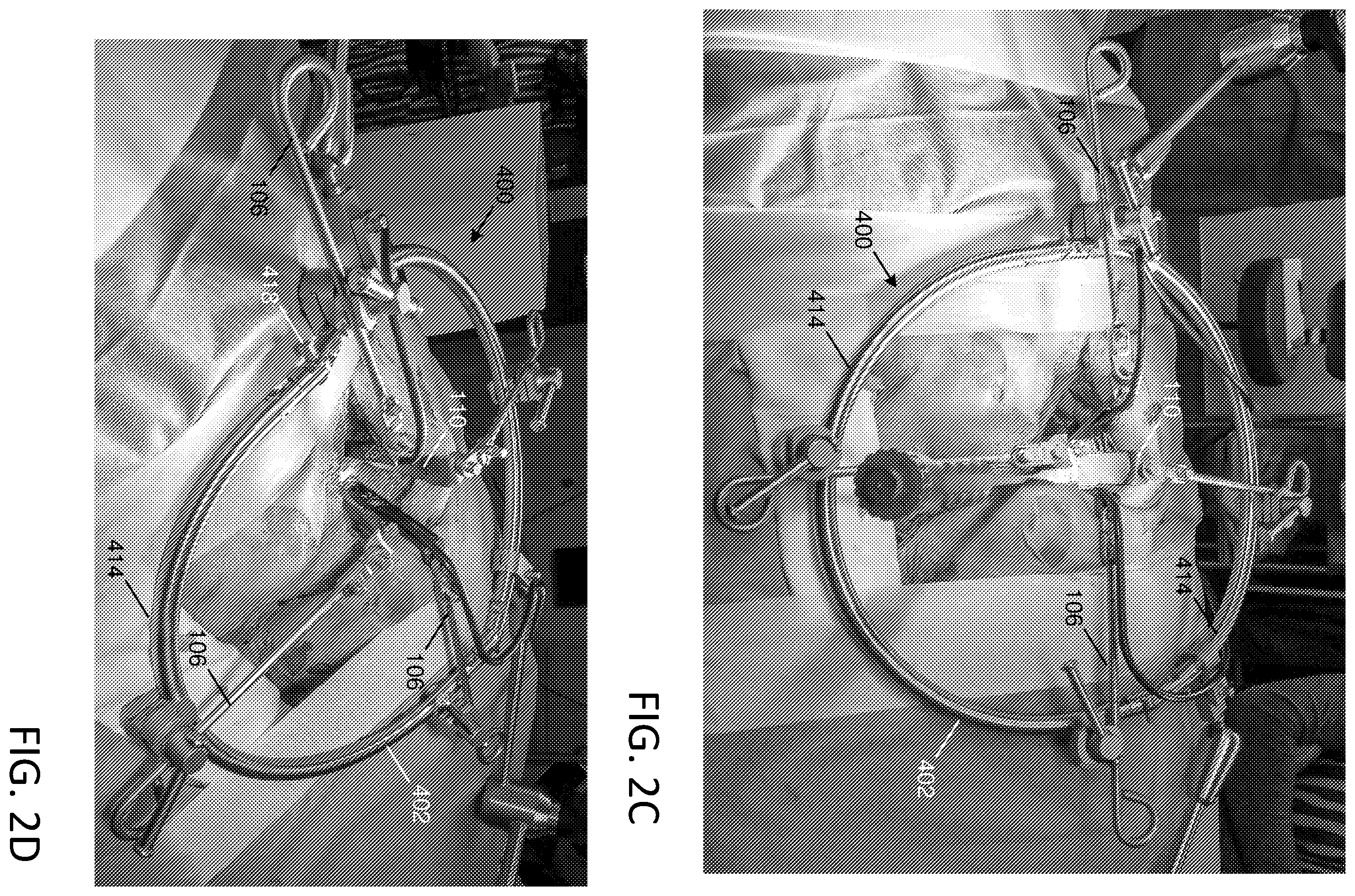 Patent US12588903 Figure 4 – Anterior to the psoas surgical access system and a modified surgical approach technique