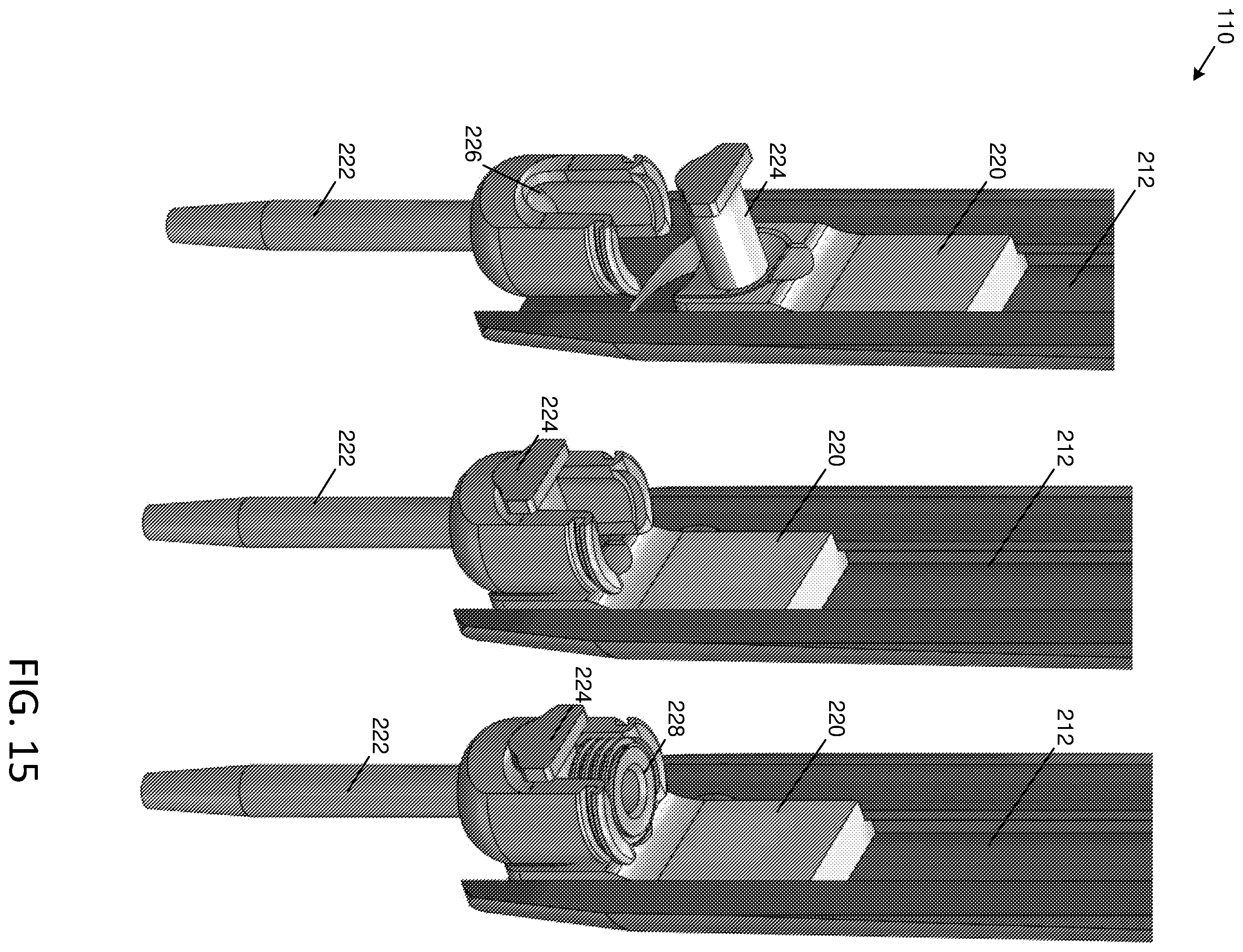 Patent US12588903 Figure 16 – Anterior to the psoas surgical access system and a modified surgical approach technique