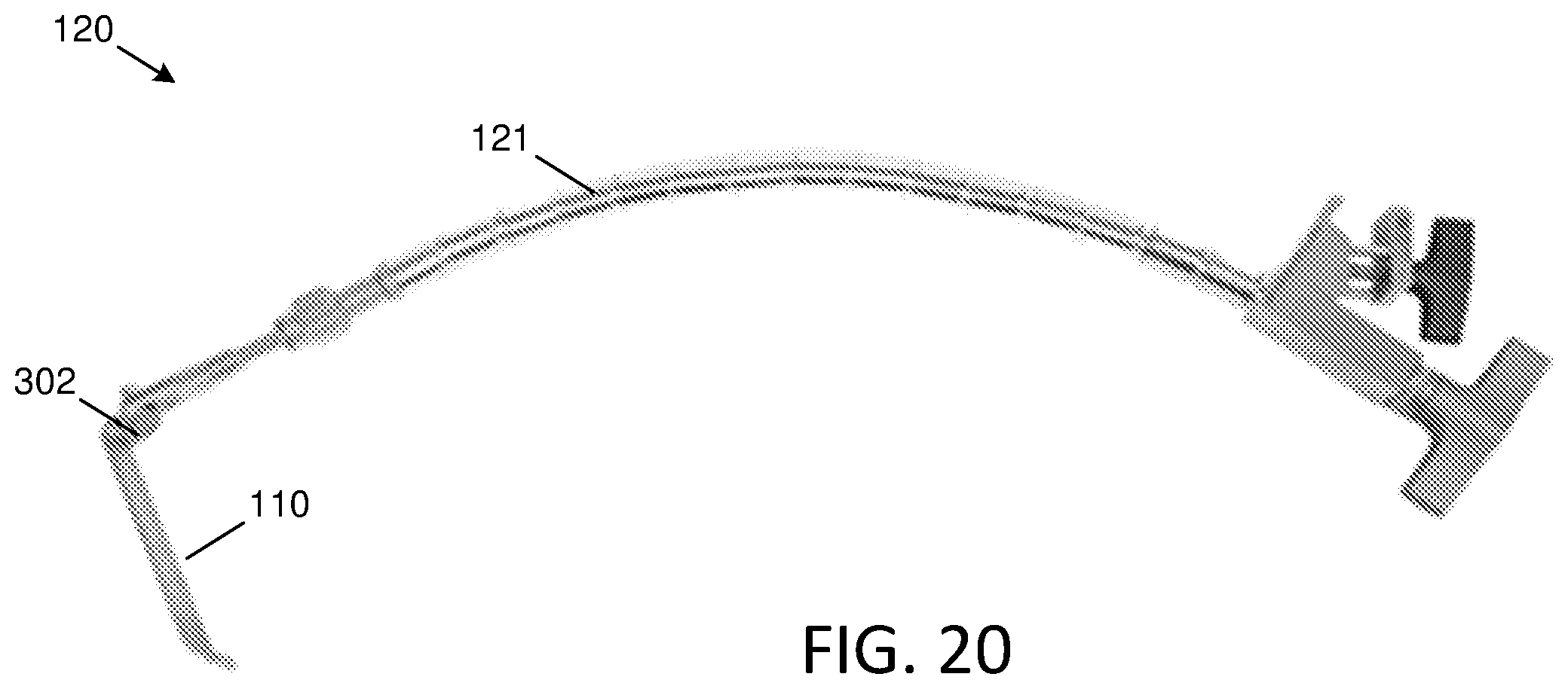Patent US12588903 Figure 20 – Anterior to the psoas surgical access system and a modified surgical approach technique