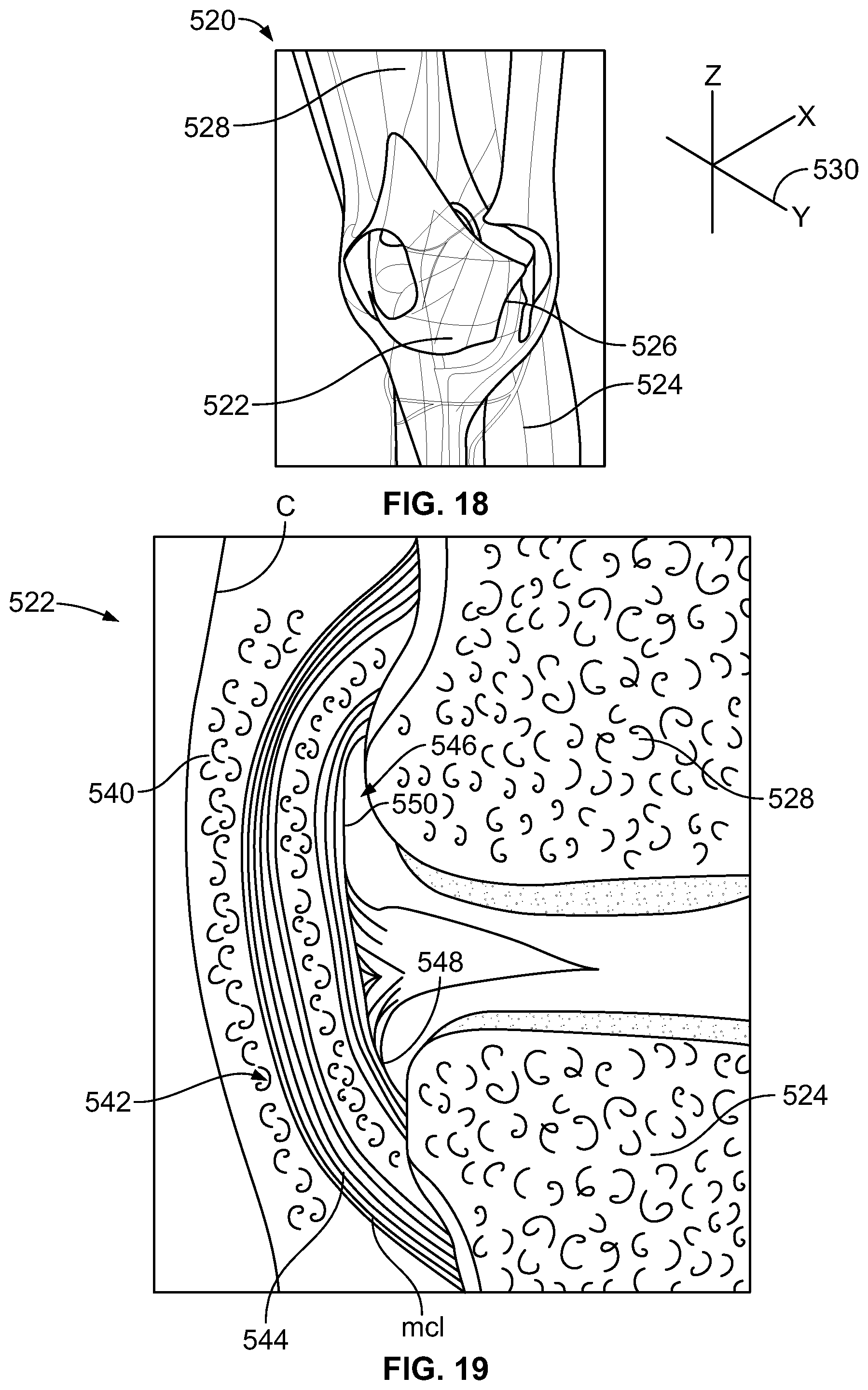 Patent US12588905 Figure 10 – Knee joint capsular disruption and repair