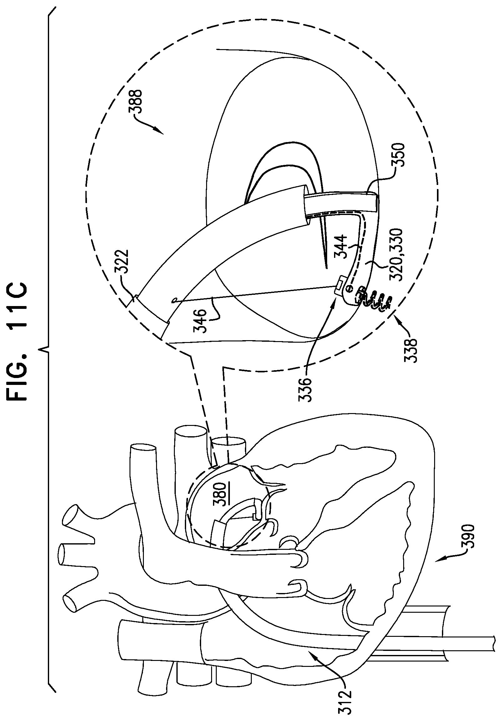 Patent US12588907 Figure 18 – Self-locking winch