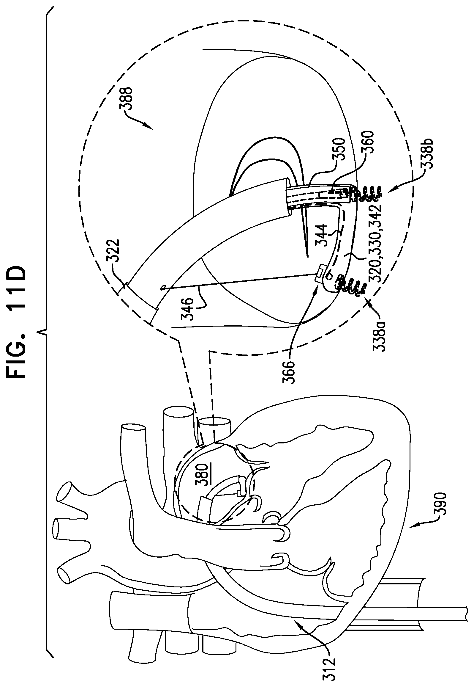 Patent US12588907 Figure 19 – Self-locking winch