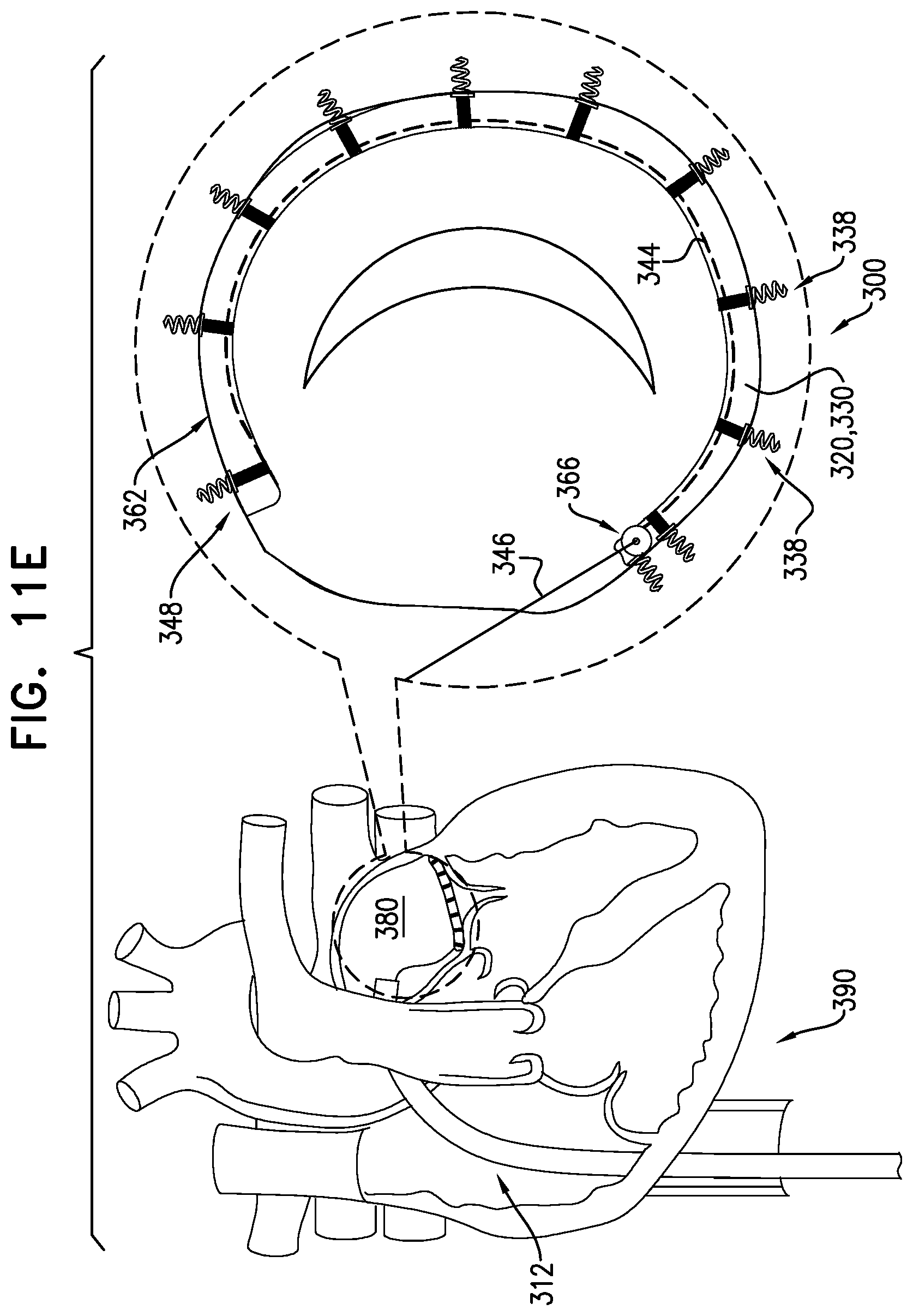 Patent US12588907 Figure 20 – Self-locking winch