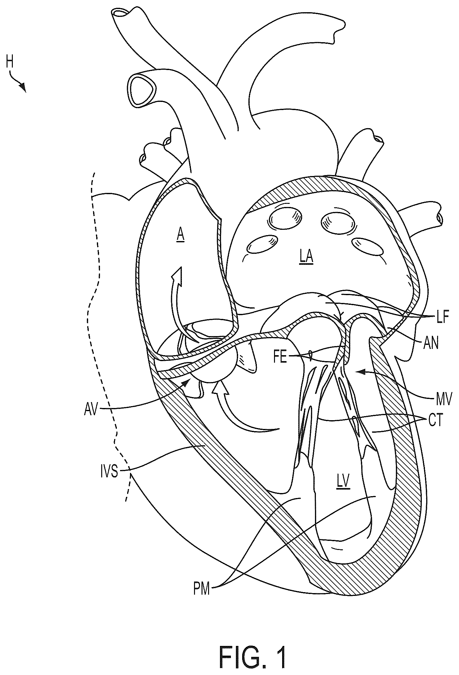 Patent US12588908 Figure 1 – Independent gripper