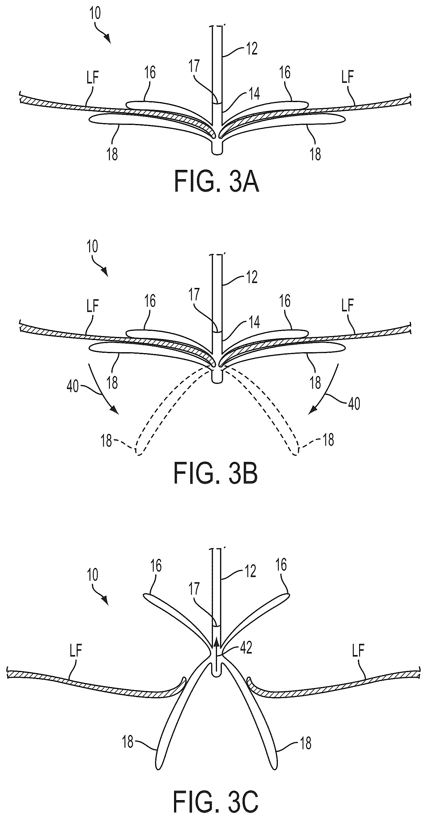 Patent US12588908 Figure 3 – Independent gripper