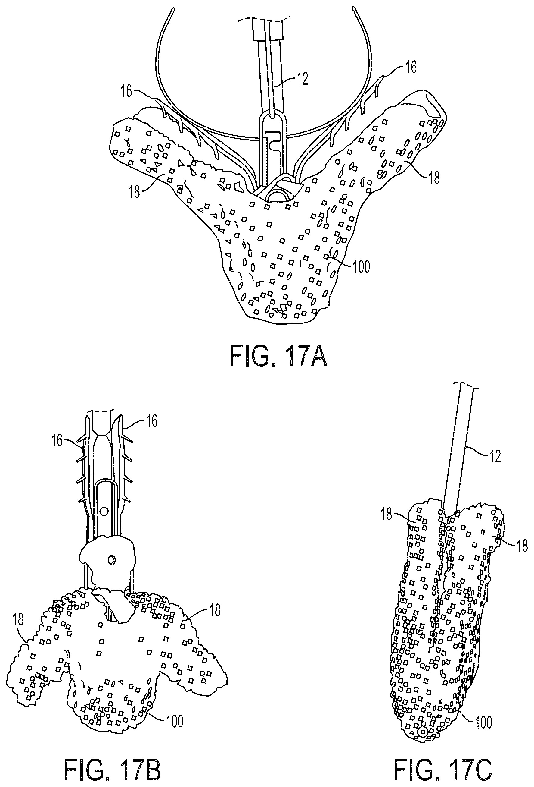 Patent US12588908 Figure 10 – Independent gripper