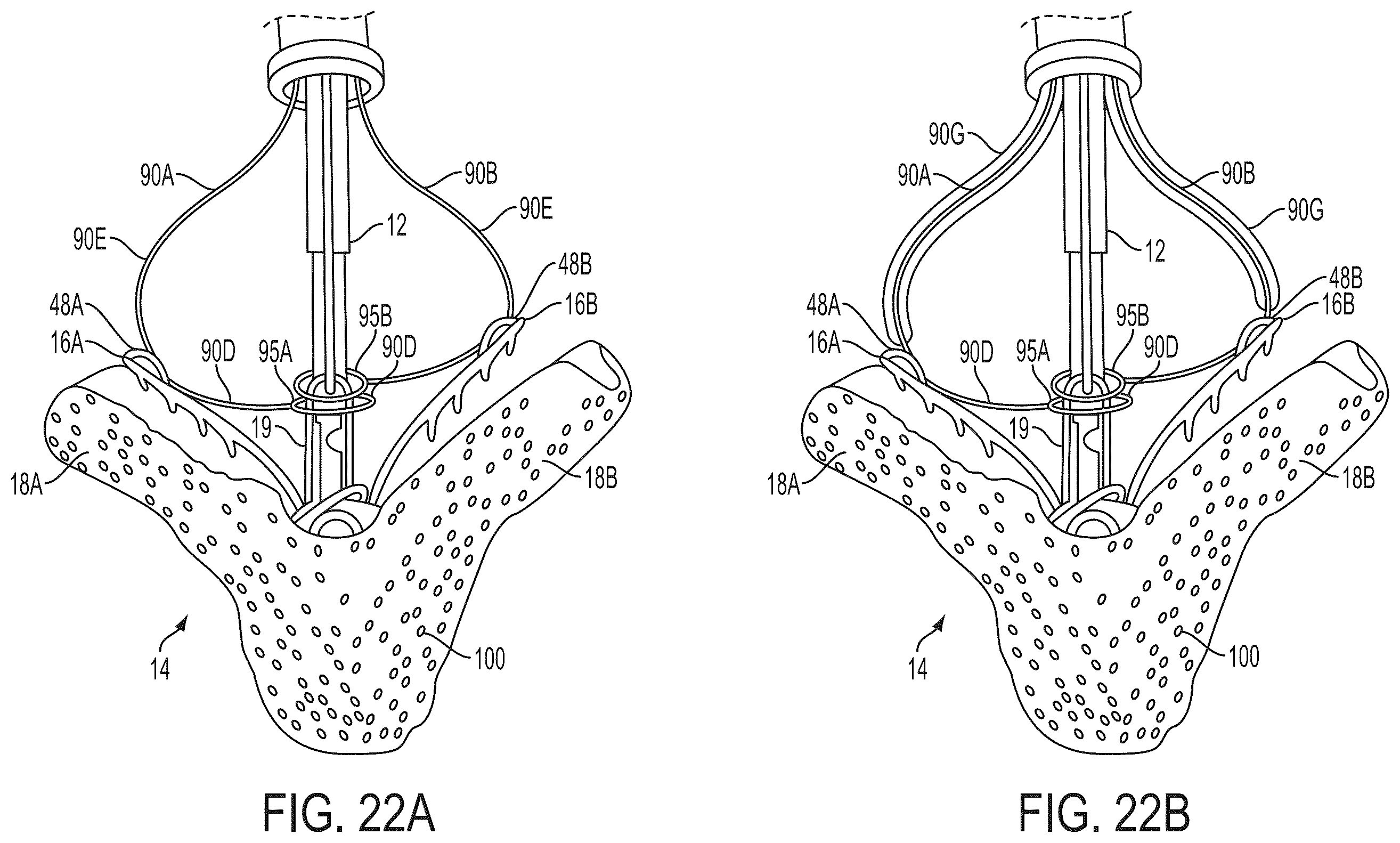 Patent US12588908 Figure 13 – Independent gripper