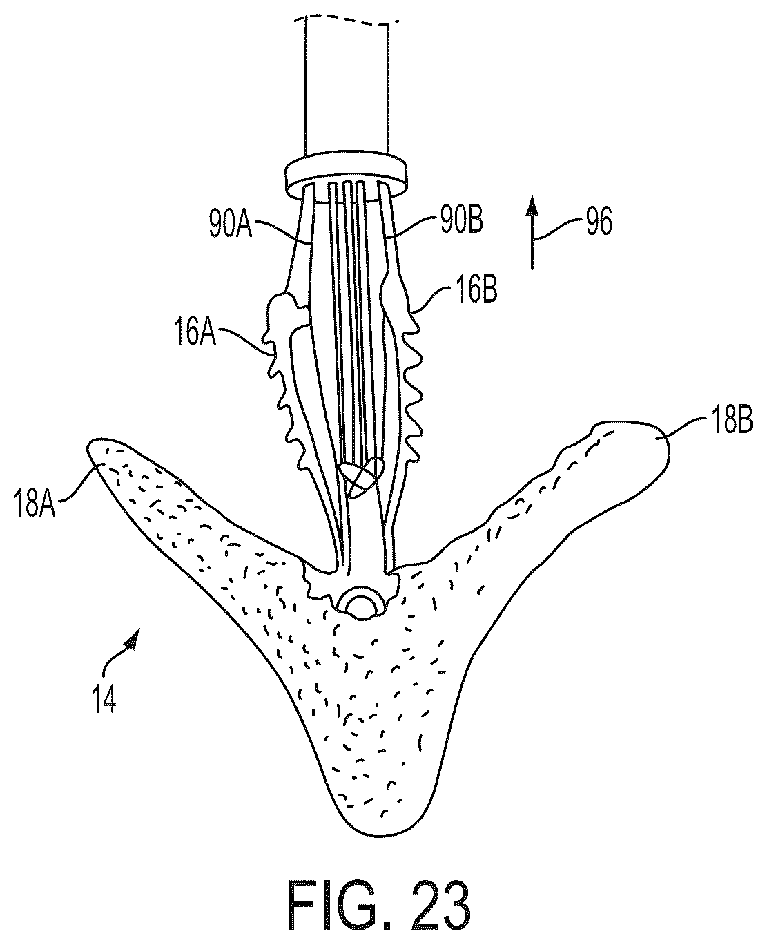 Patent US12588908 Figure 14 – Independent gripper