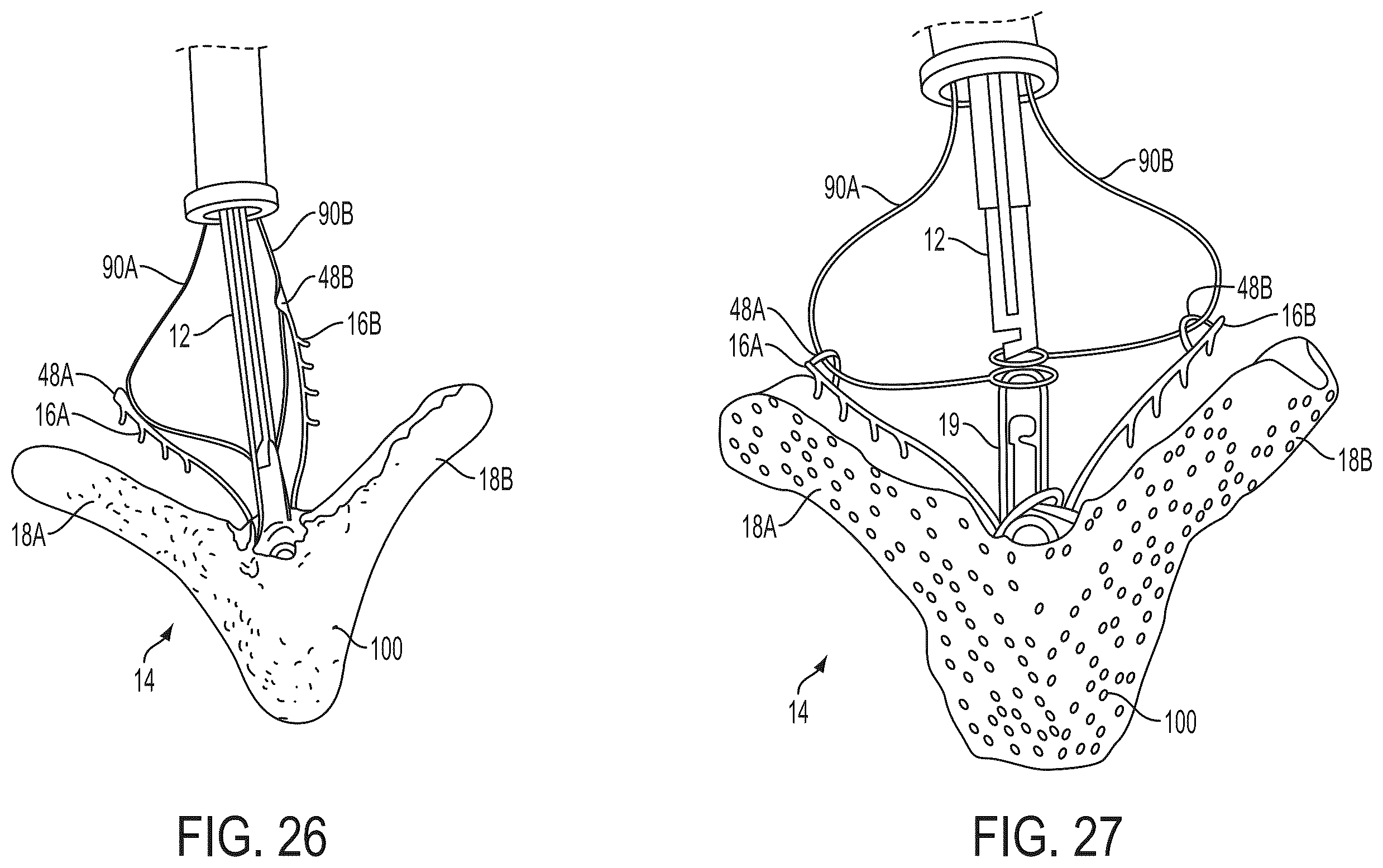 Patent US12588908 Figure 16 – Independent gripper