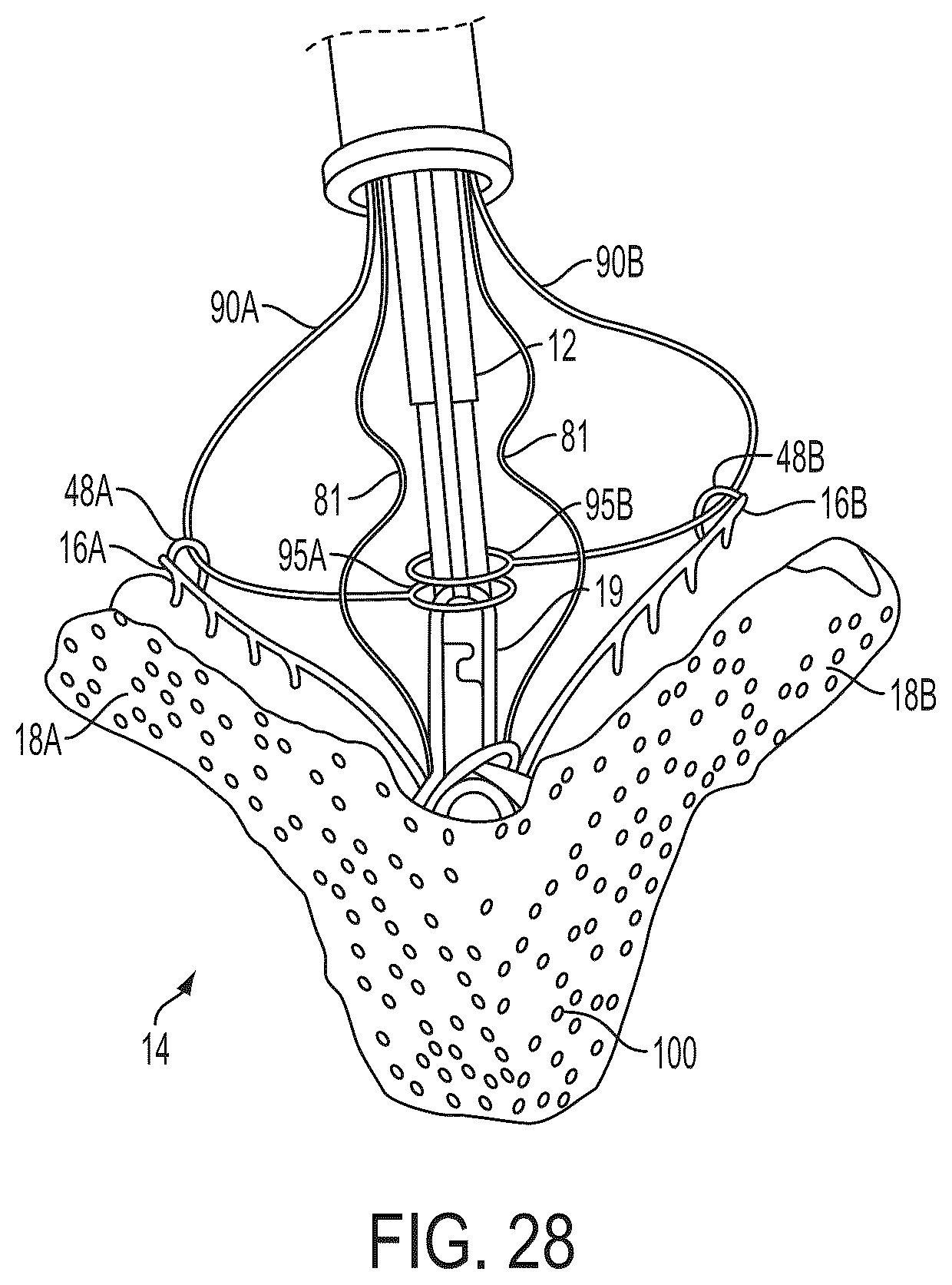 Patent US12588908 Figure 17 – Independent gripper