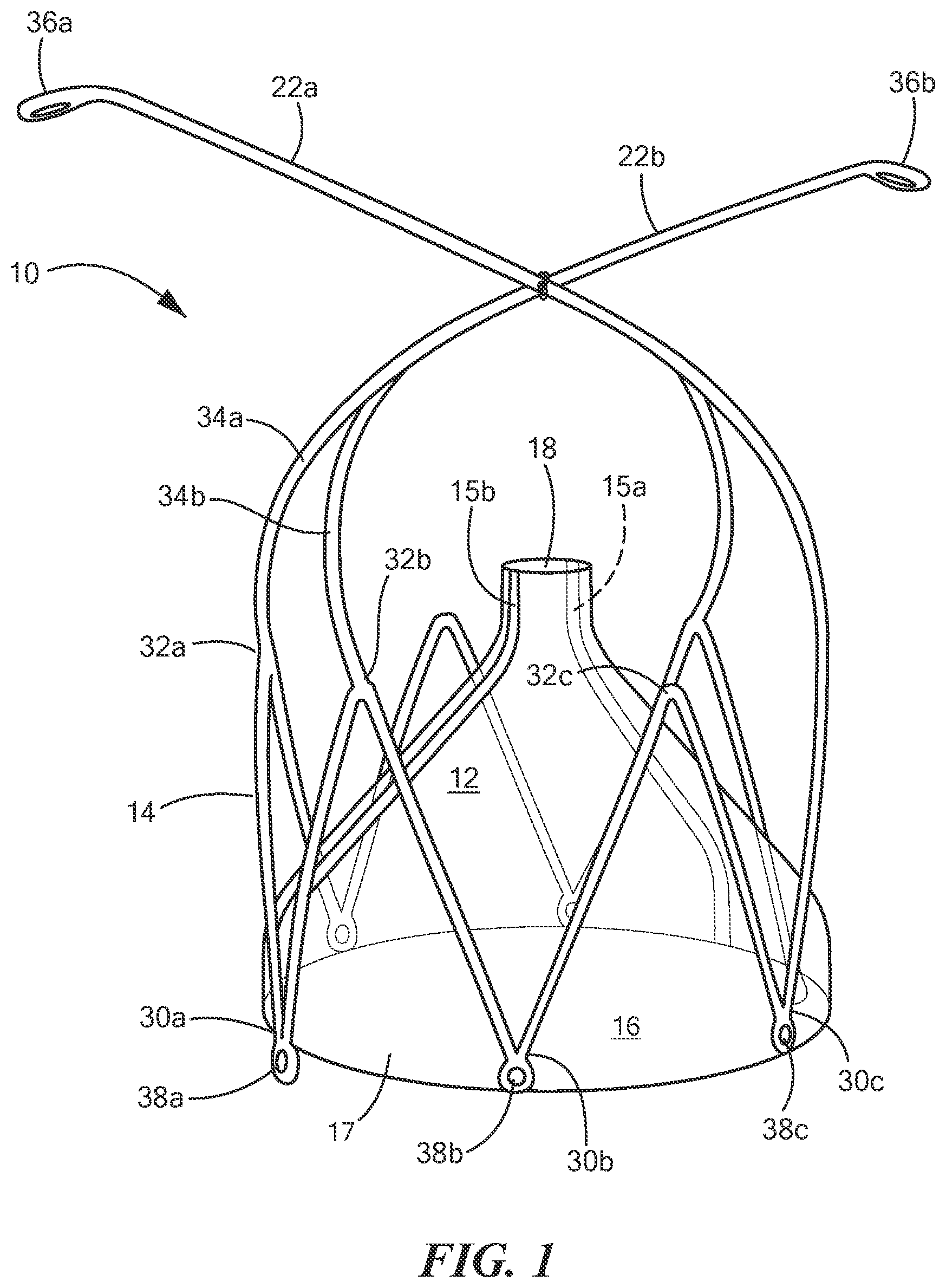 Patent US12588909 Figure 1 – Transcatheter device and minimally invasive method for constricting and adjusting blood flow through a blood vessel