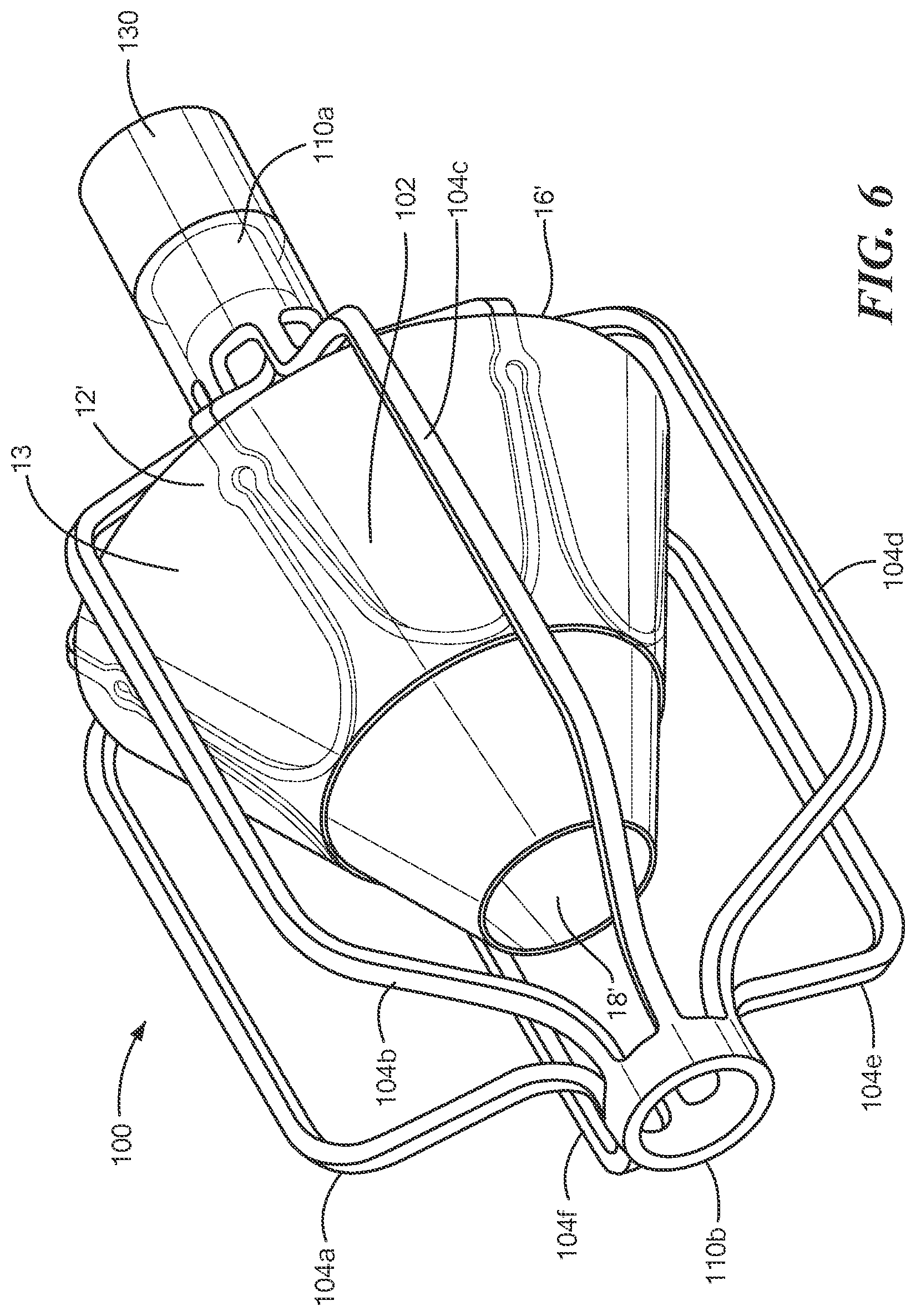 Patent US12588909 Figure 9 – Transcatheter device and minimally invasive method for constricting and adjusting blood flow through a blood vessel